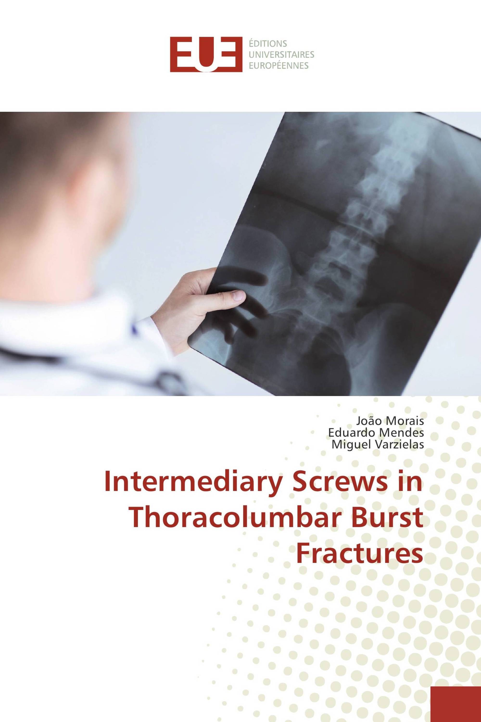 Intermediary Screws in Thoracolumbar Burst Fractures