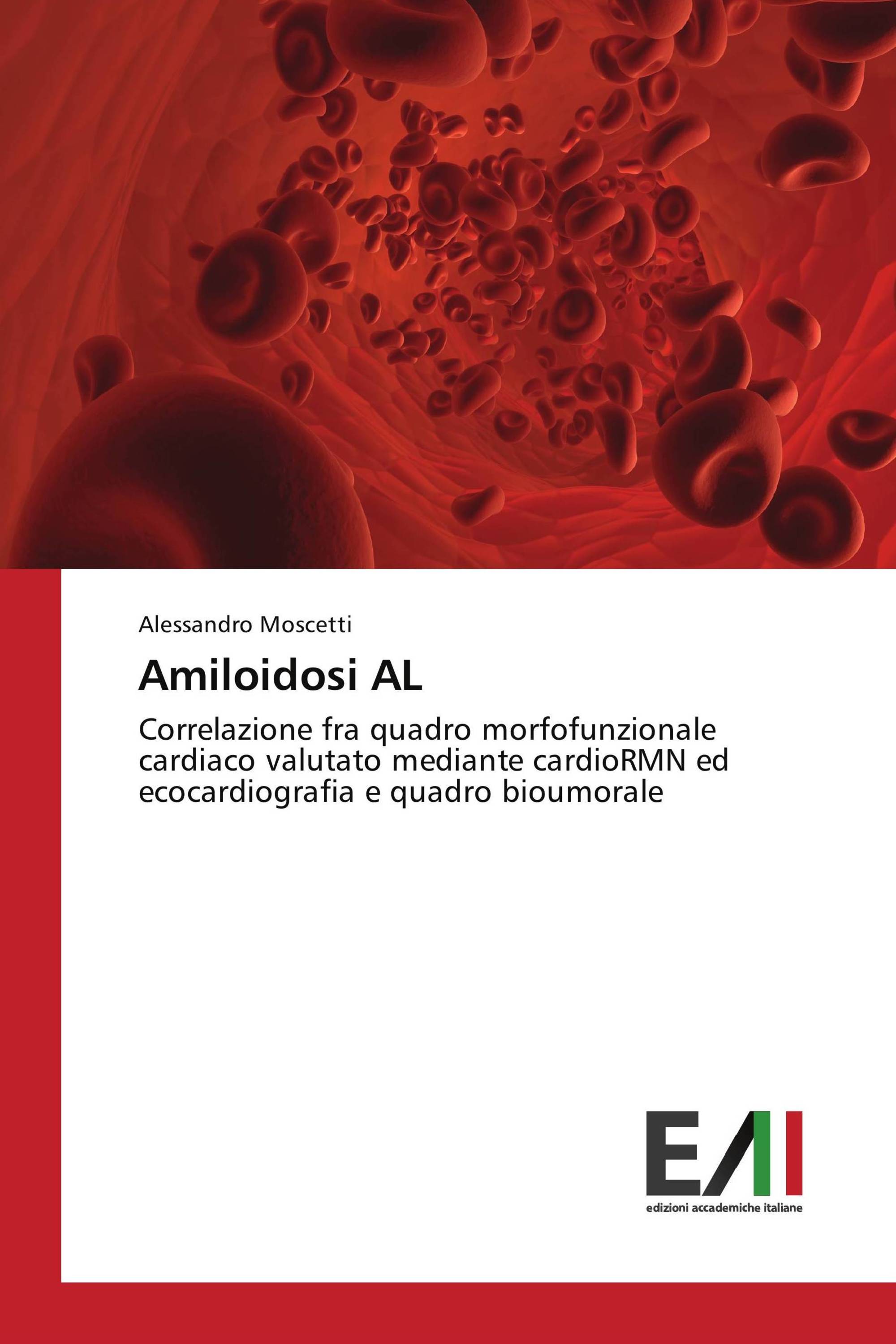 Amiloidosi AL