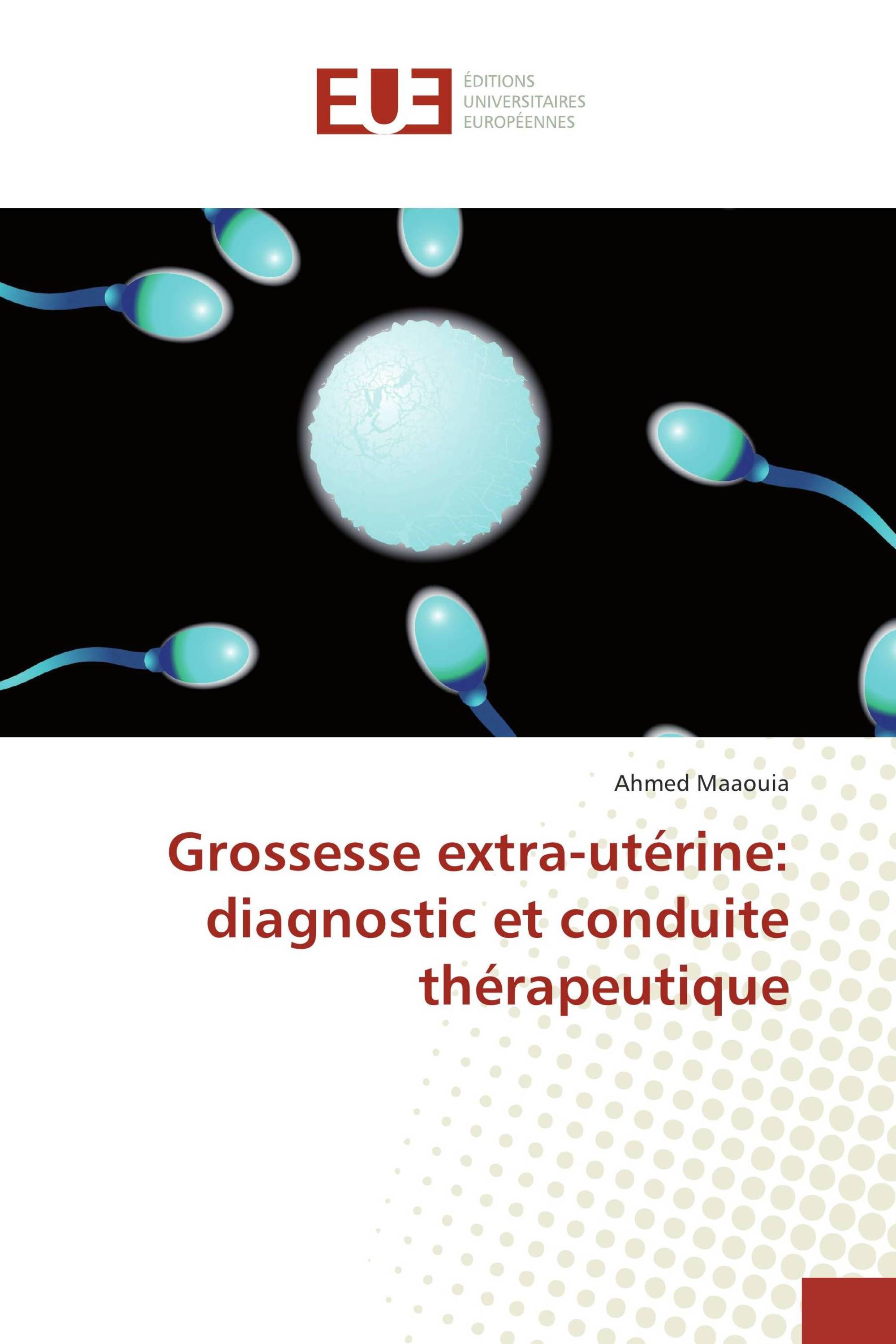 Grossesse extra-utérine: diagnostic et conduite thérapeutique