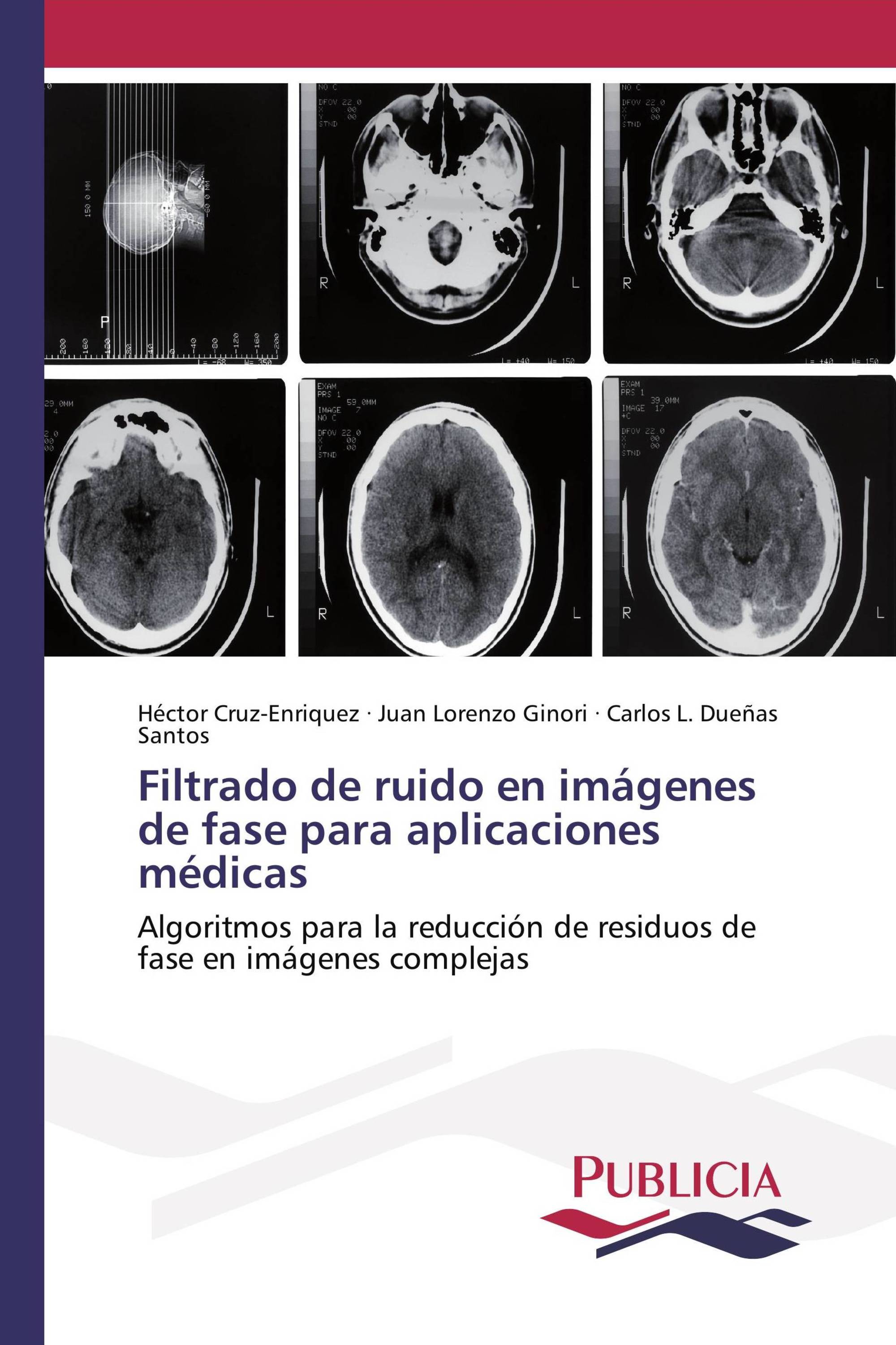 Filtrado de ruido en imágenes de fase para aplicaciones médicas