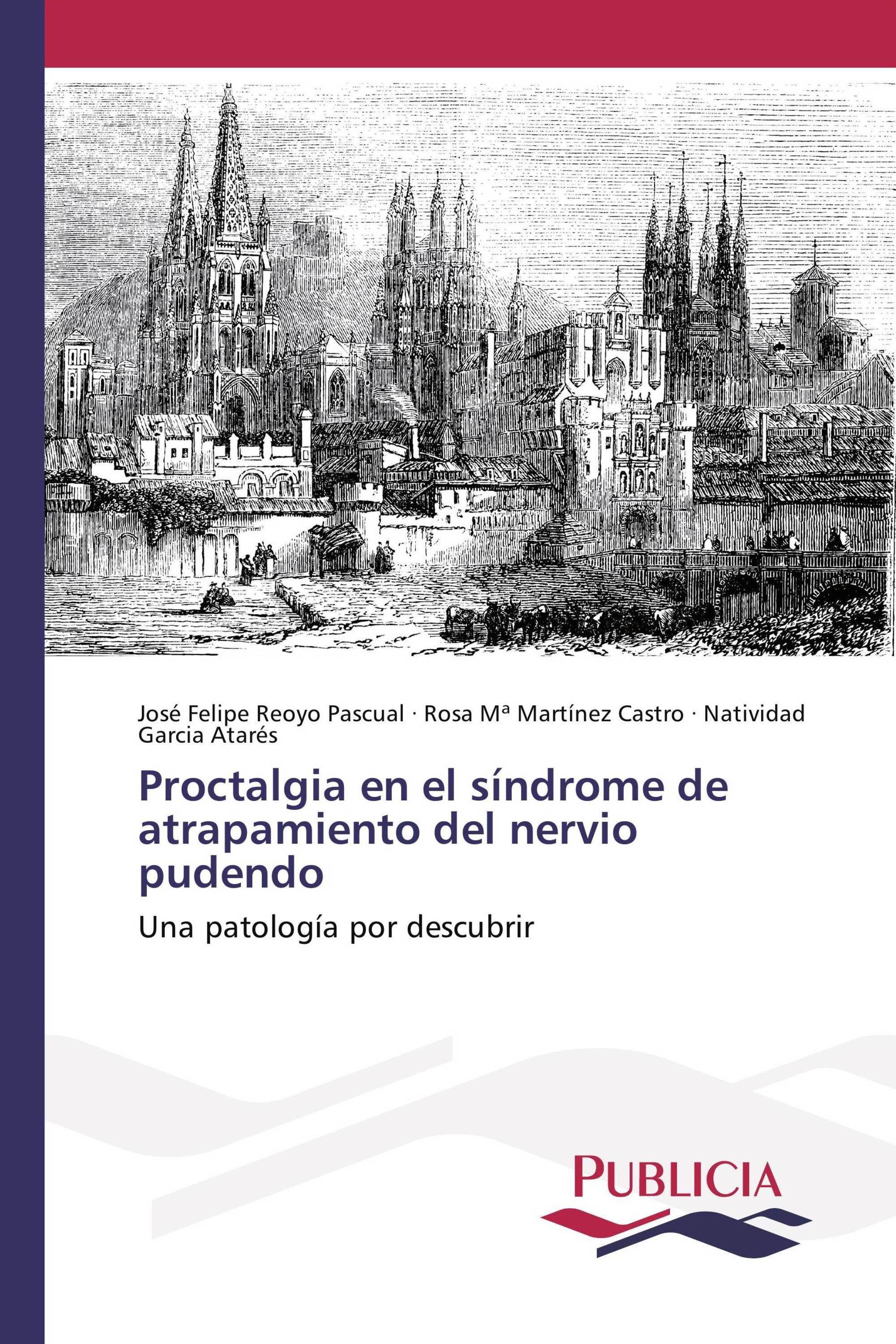 Proctalgia en el síndrome de atrapamiento del nervio pudendo