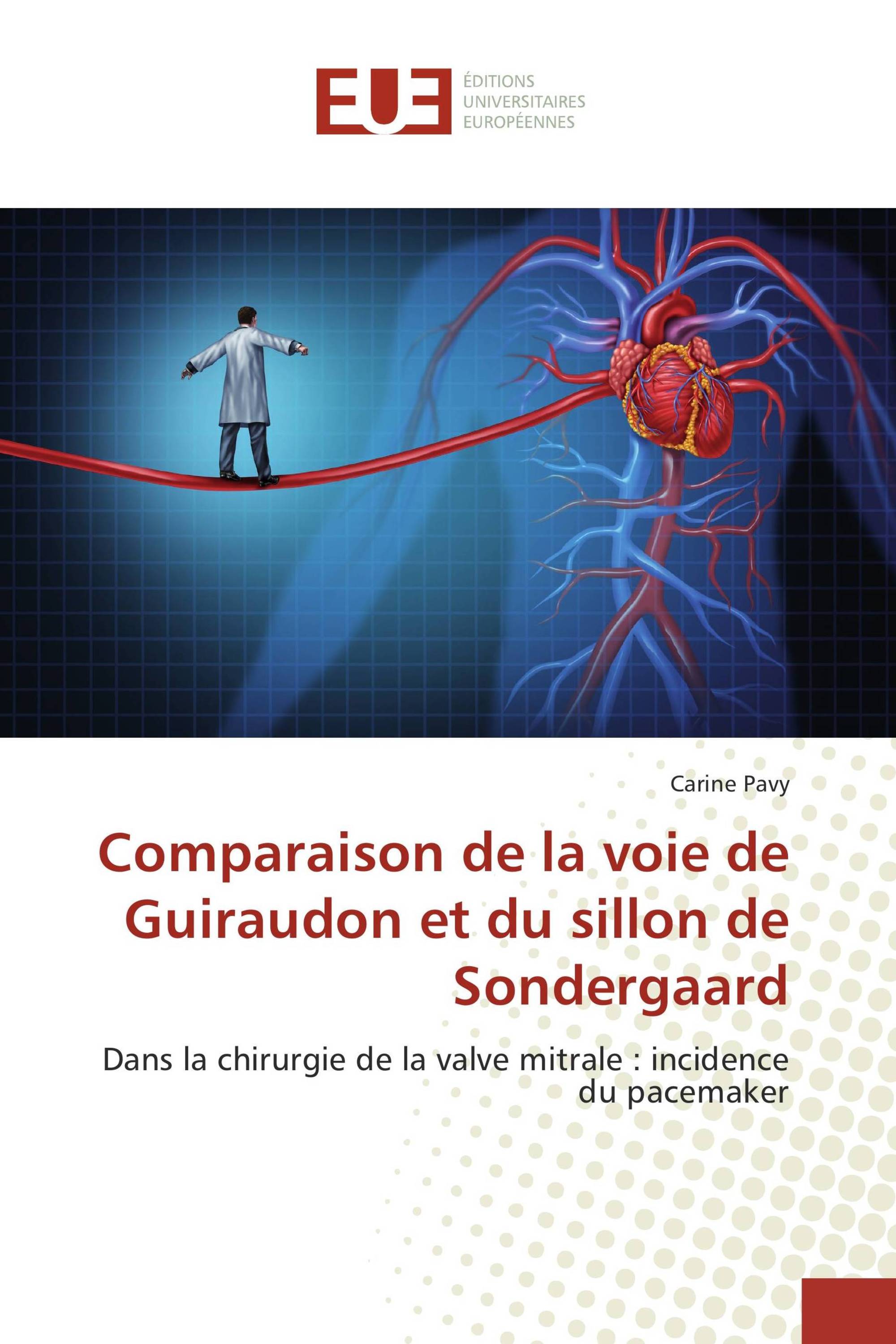 Comparaison de la voie de Guiraudon et du sillon de Sondergaard