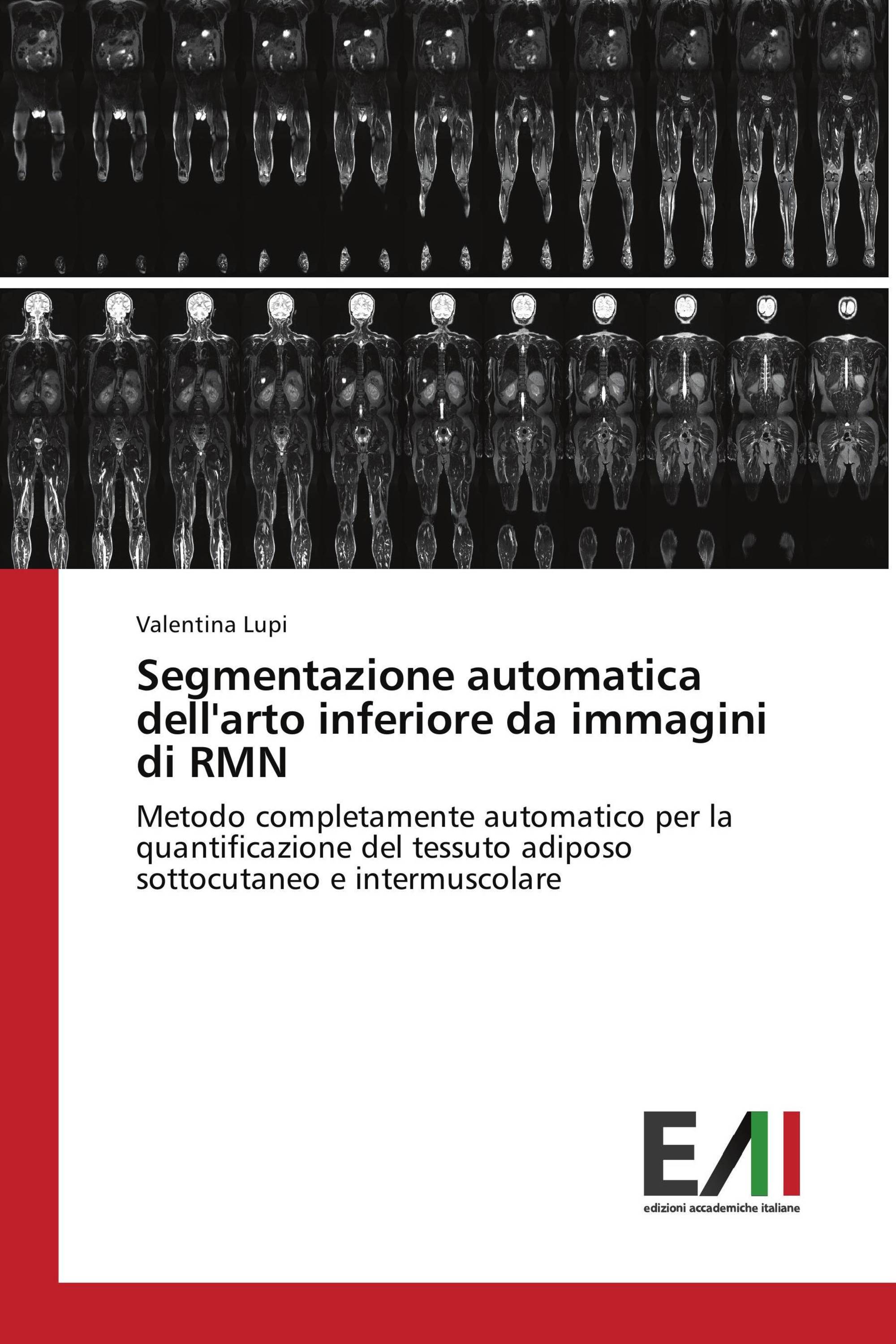 Segmentazione automatica dell'arto inferiore da immagini di RMN