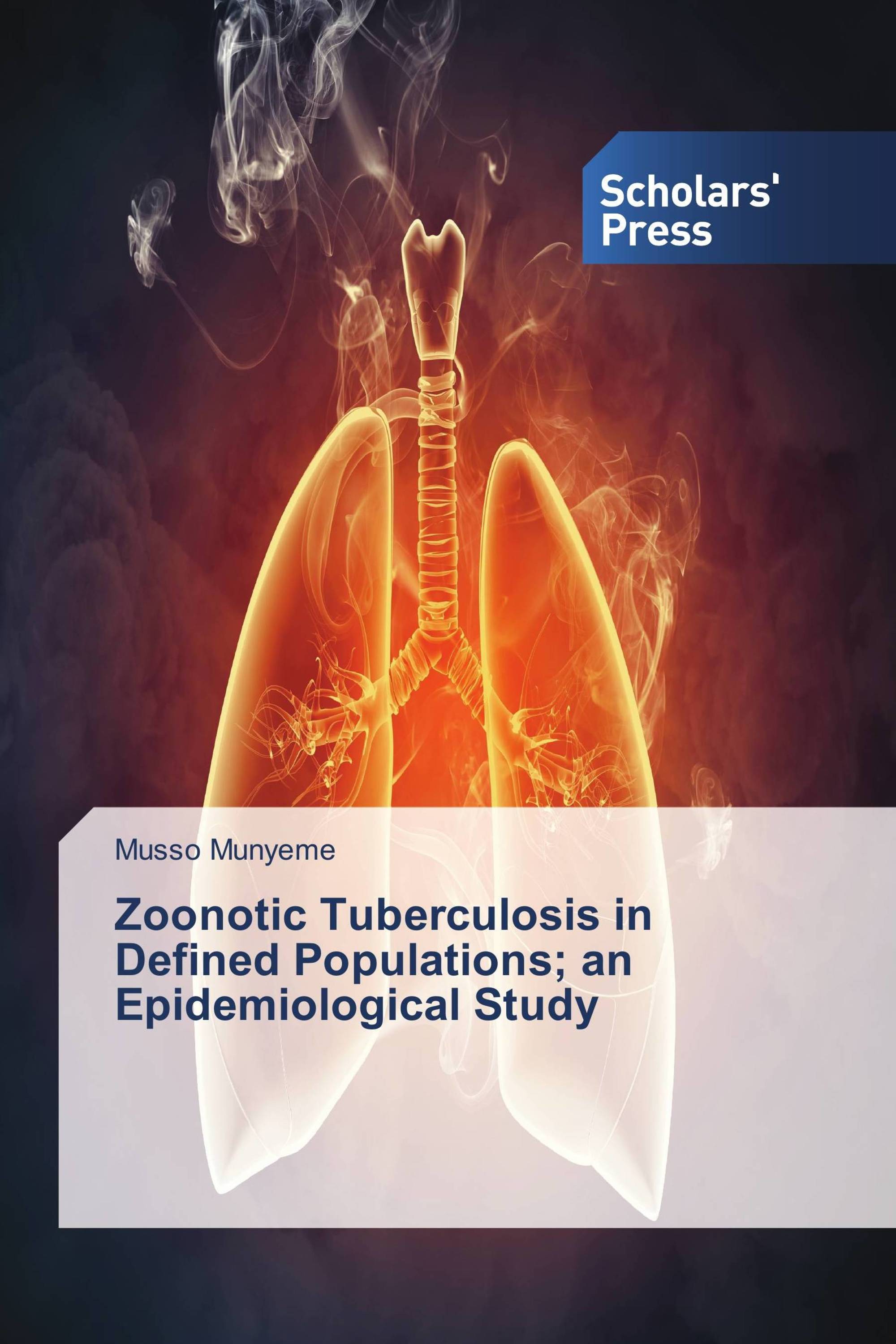 Zoonotic Tuberculosis In Defined Populations; An Epidemiological Study