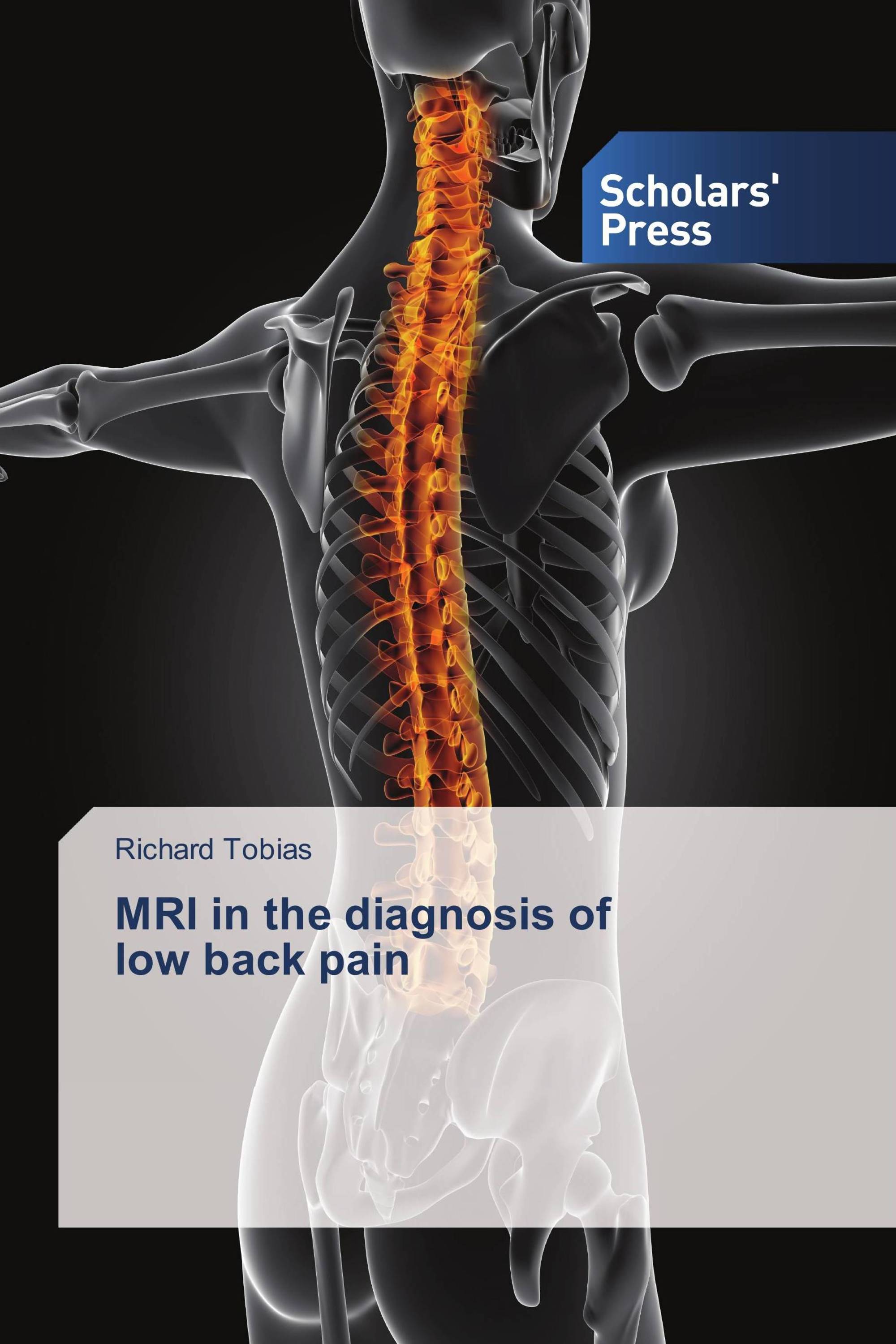 MRI in the diagnosis of low back pain