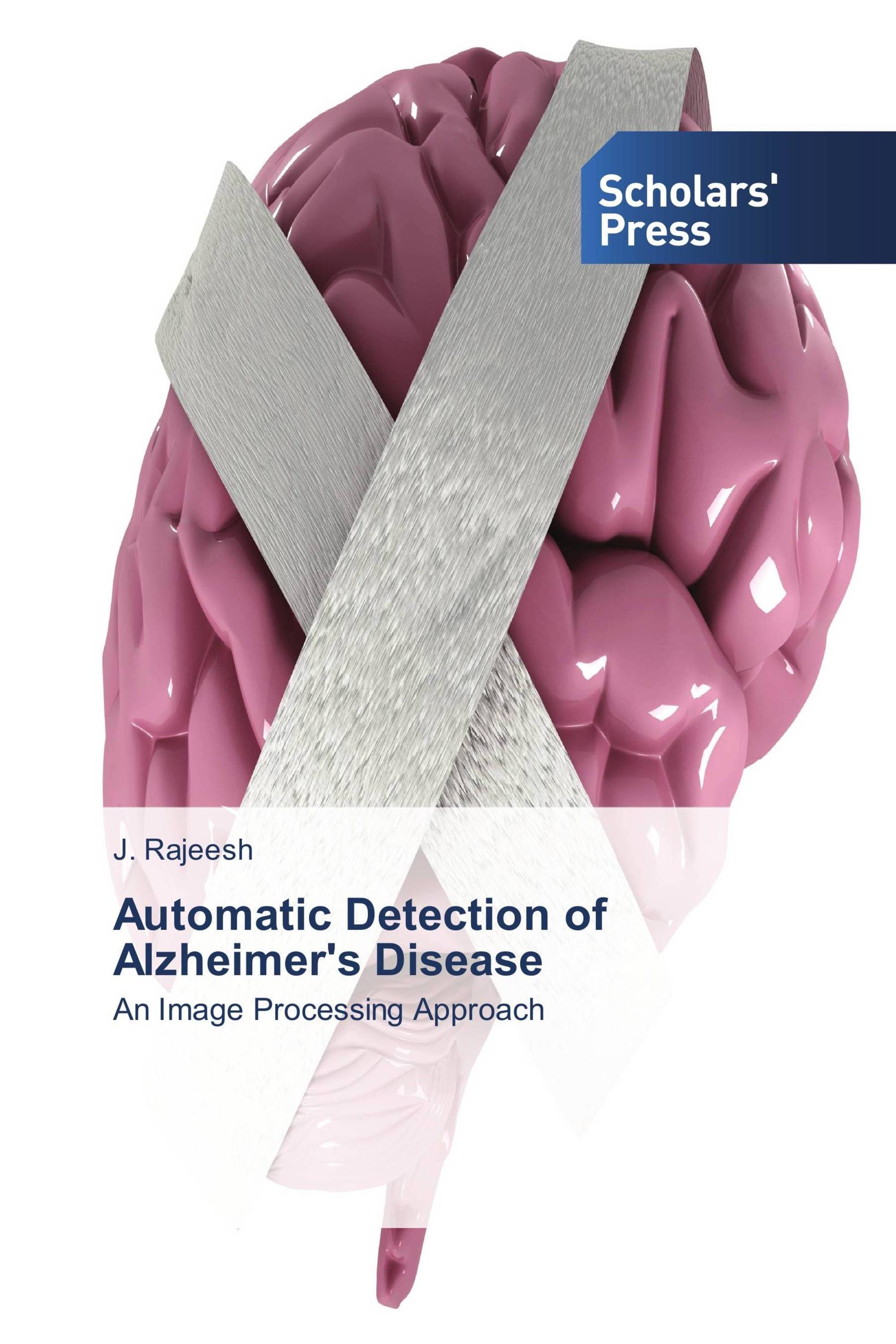 Automatic Detection of Alzheimer's Disease