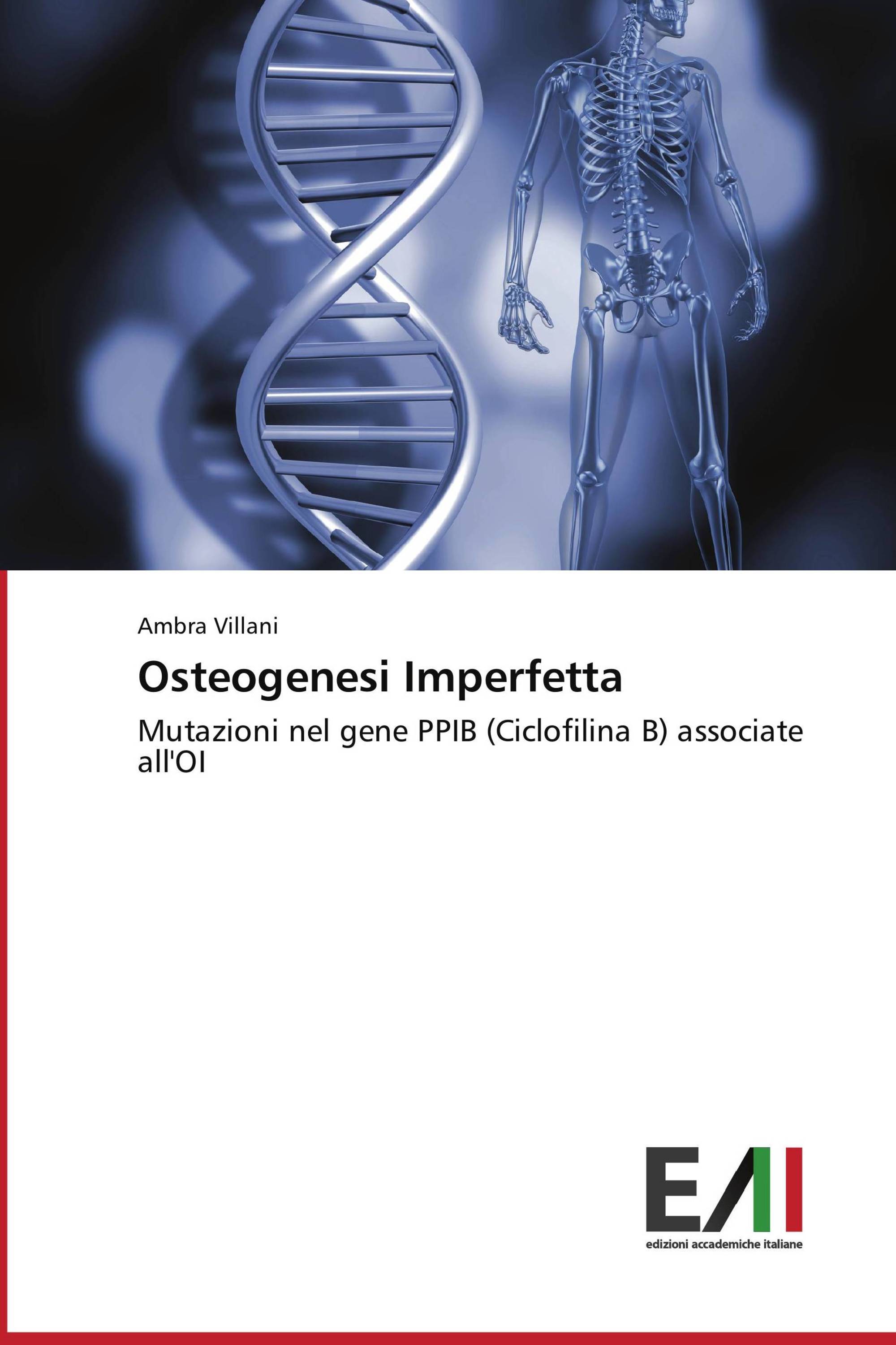 Osteogenesi Imperfetta