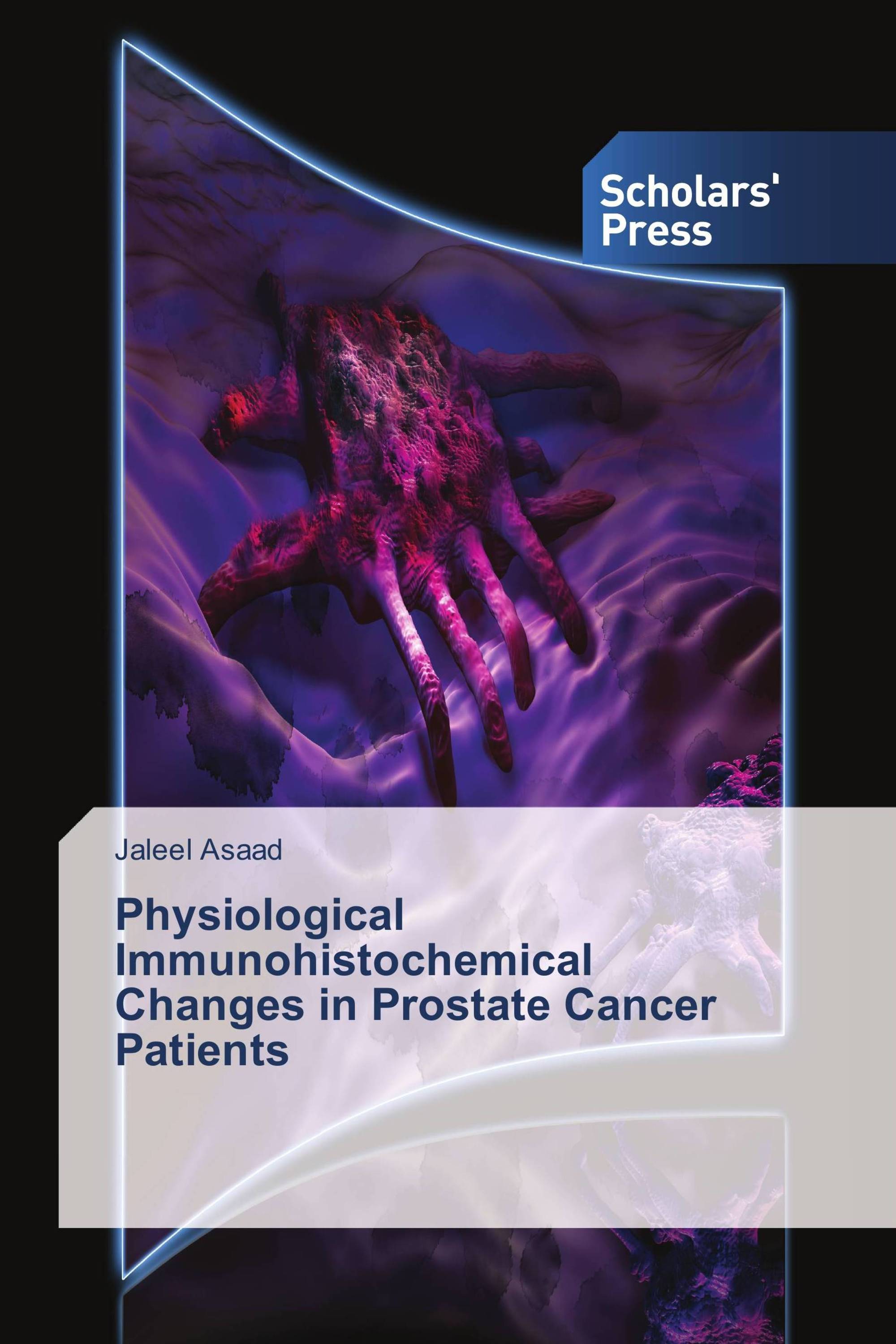 Physiological Immunohistochemical Changes in Prostate Cancer Patients