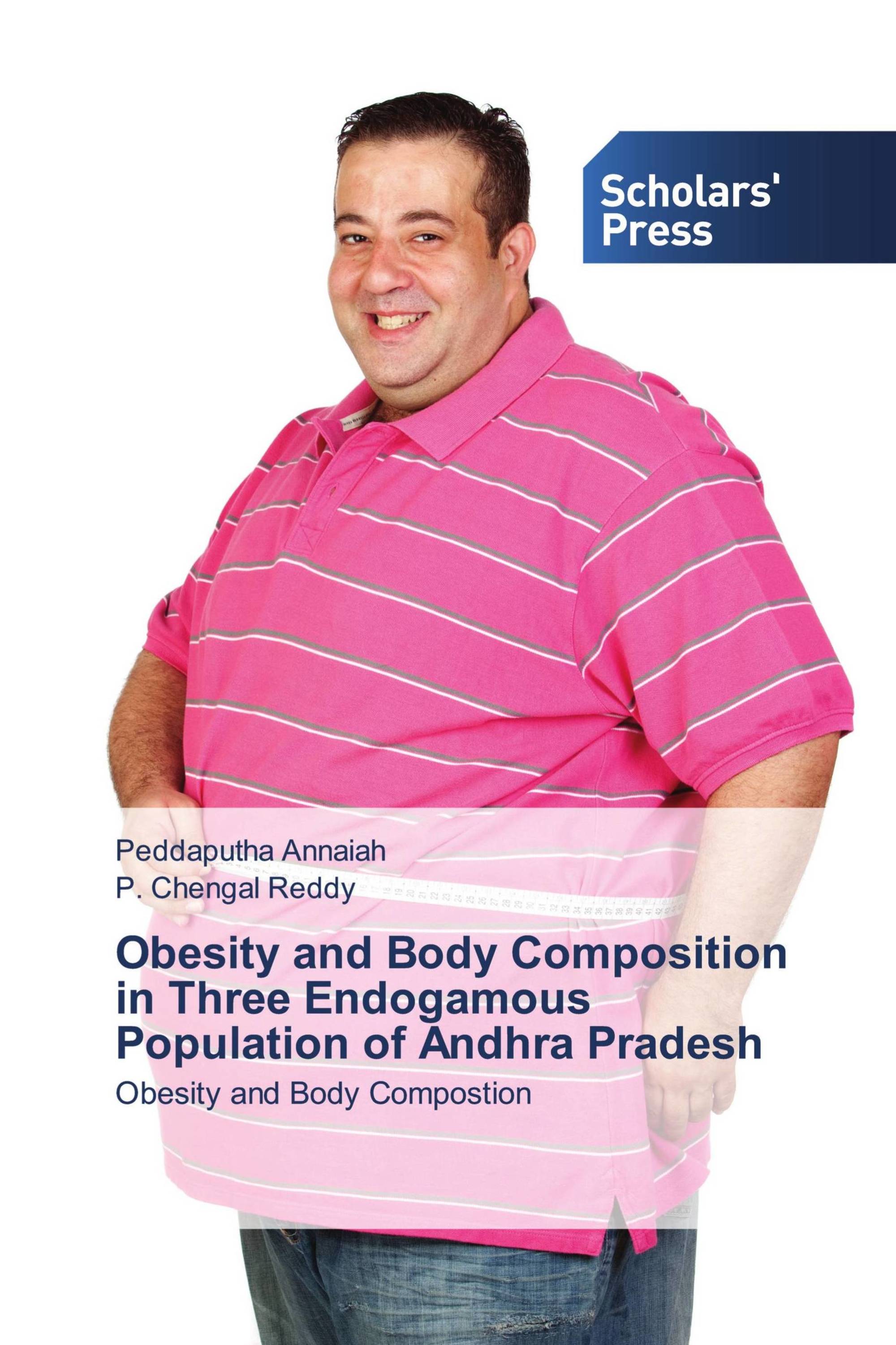 Obesity and Body Composition in Three Endogamous Population of Andhra Pradesh