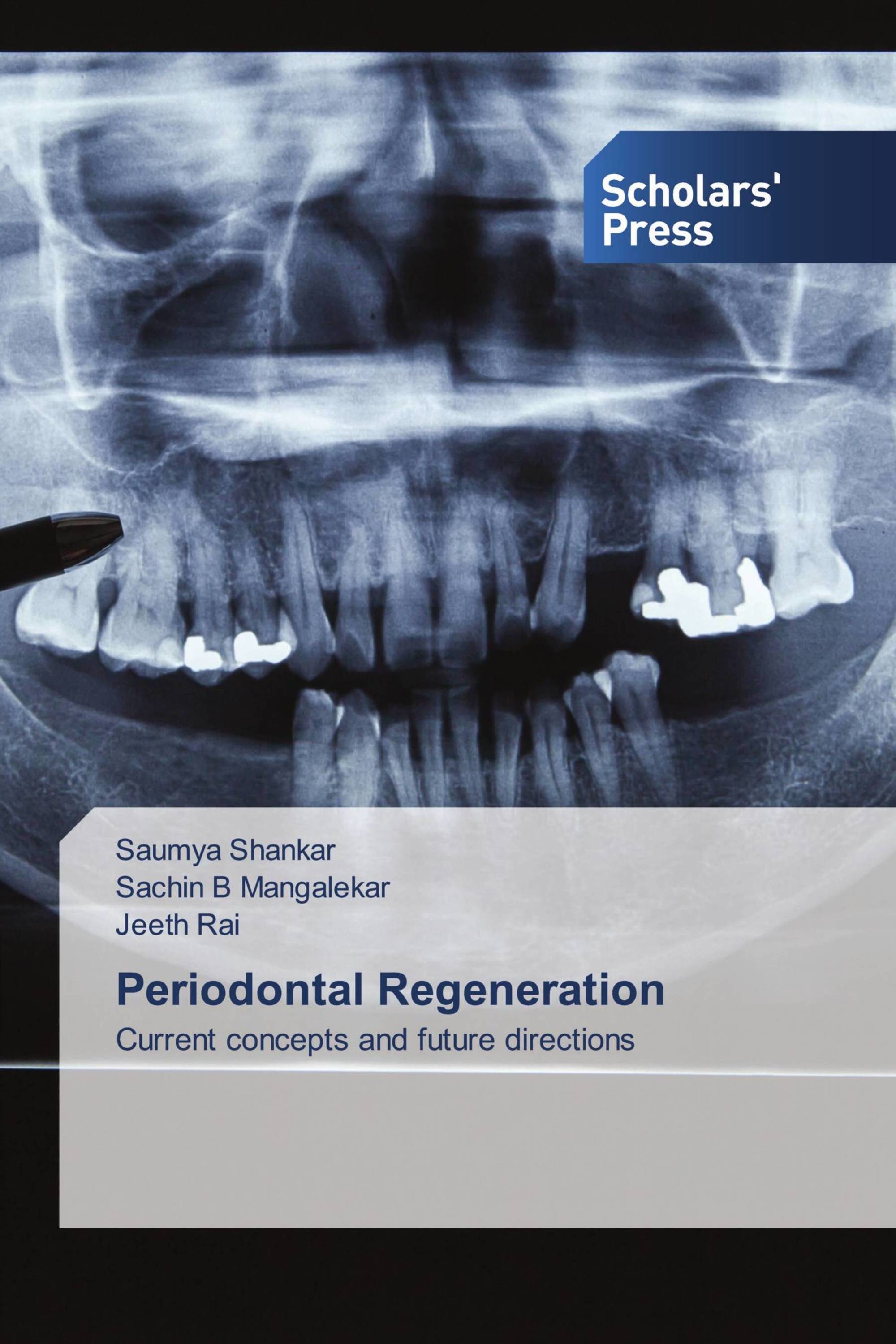 Periodontal Regeneration