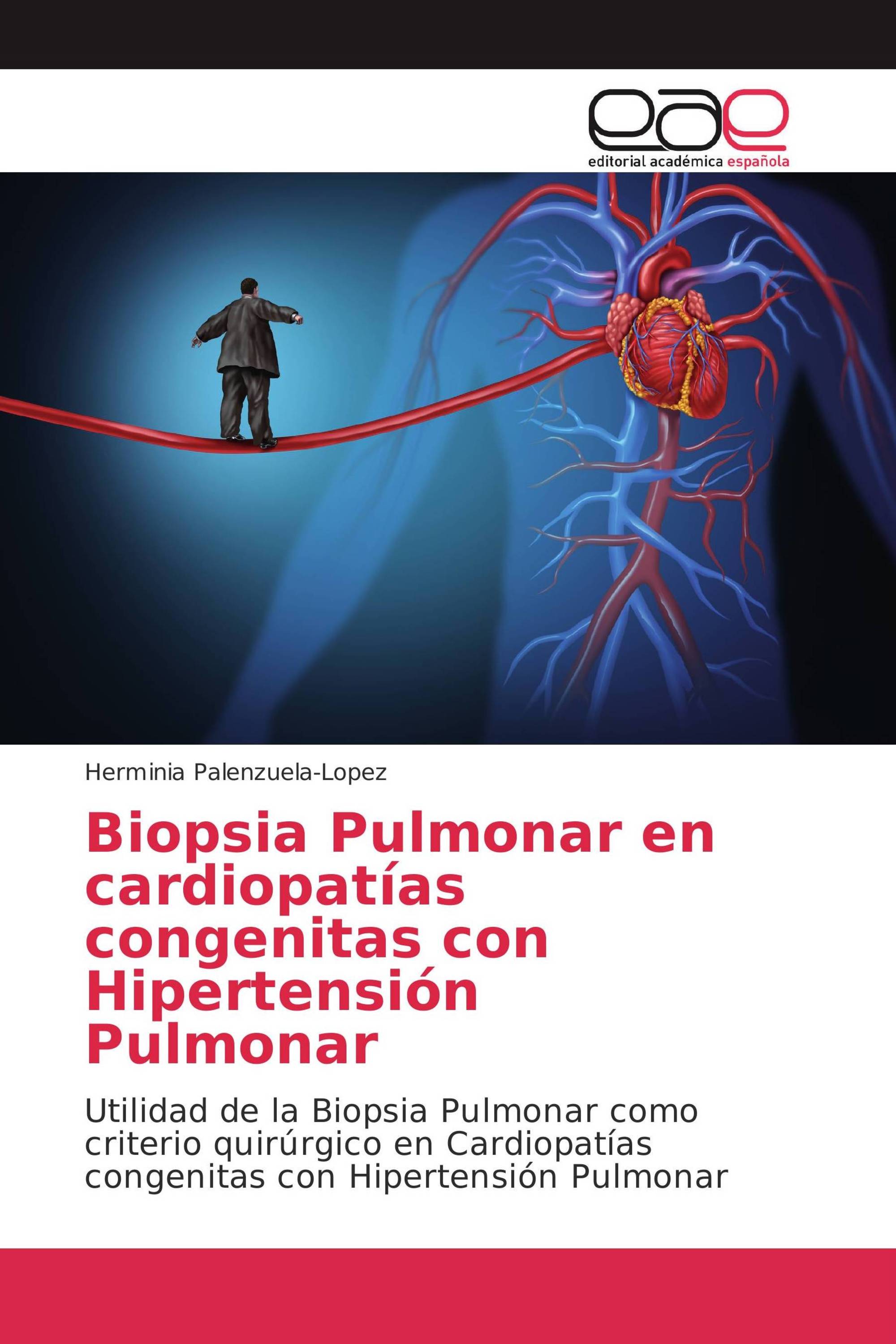 Biopsia Pulmonar en cardiopatías congenitas con Hipertensión Pulmonar