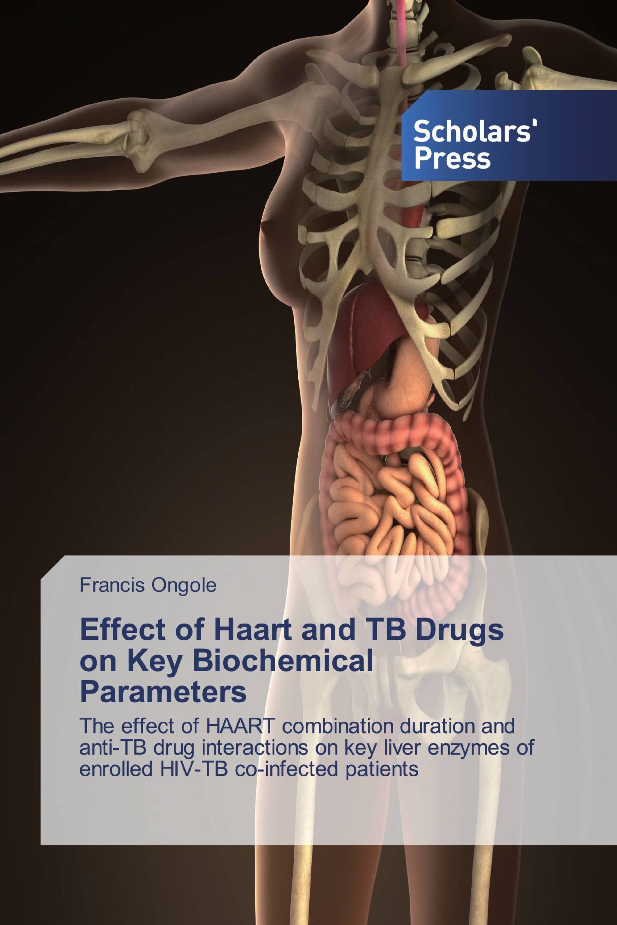 Effect of Haart and TB Drugs on Key Biochemical Parameters