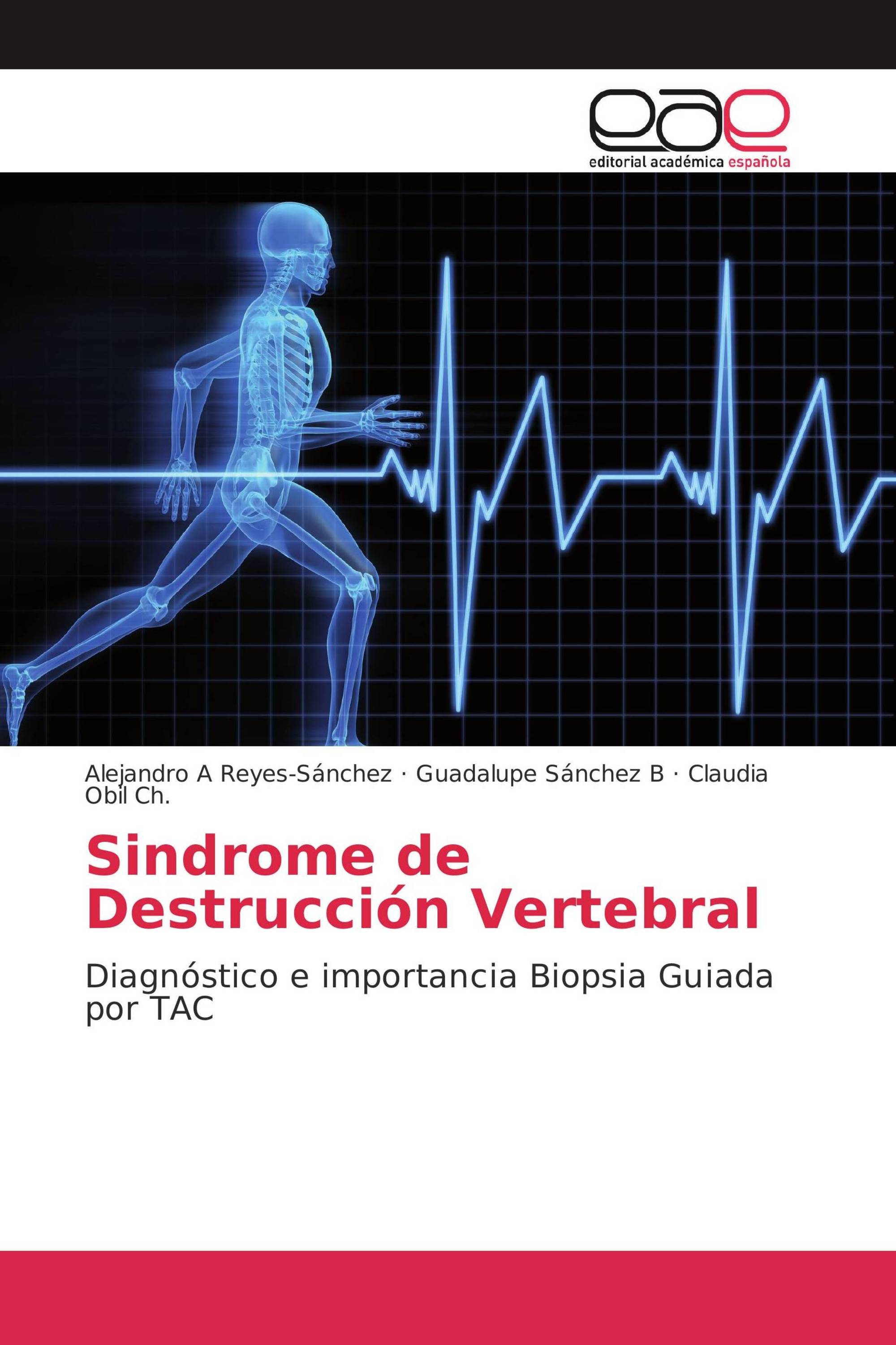 Sindrome de Destrucción Vertebral