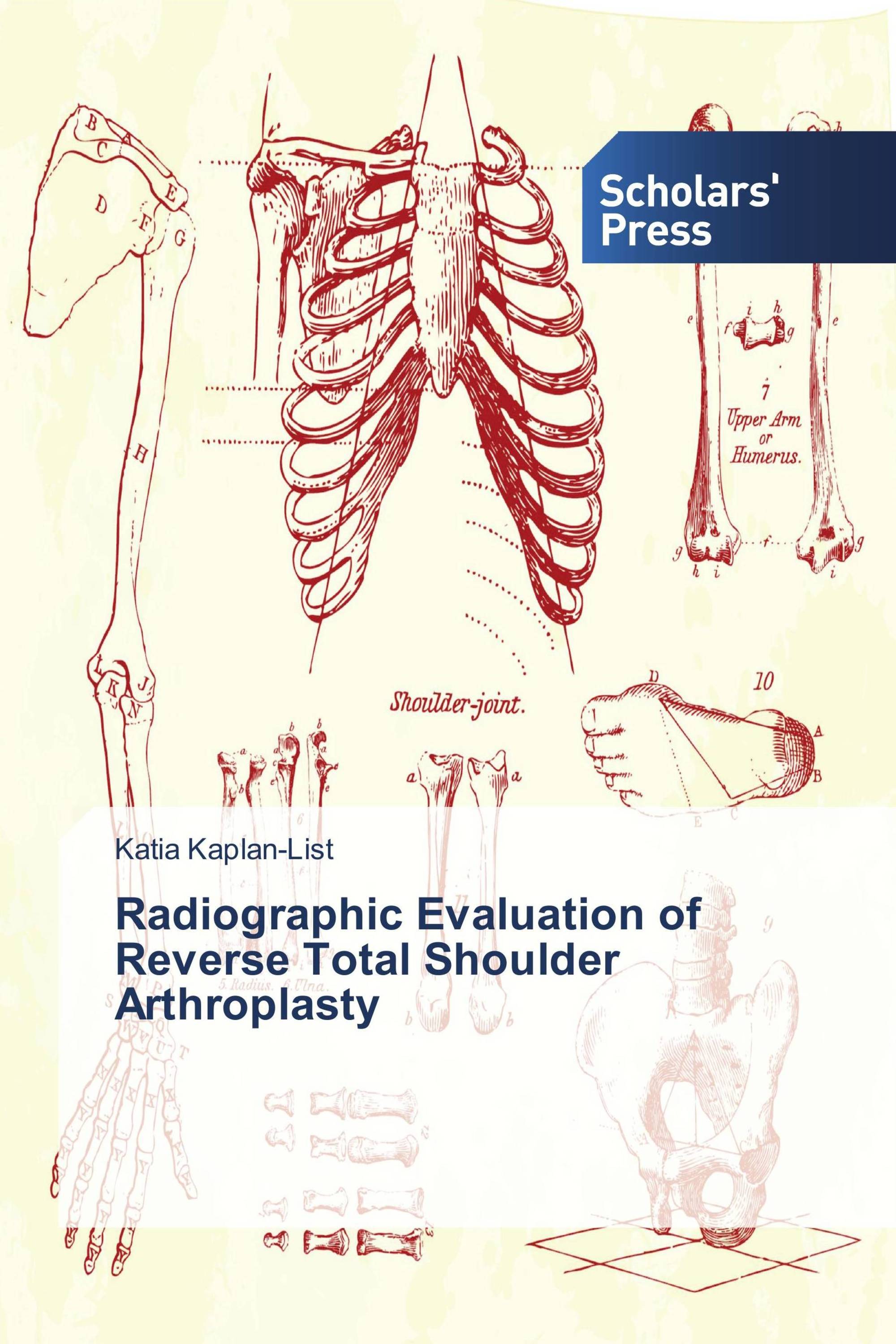 Radiographic Evaluation of Reverse Total Shoulder Arthroplasty