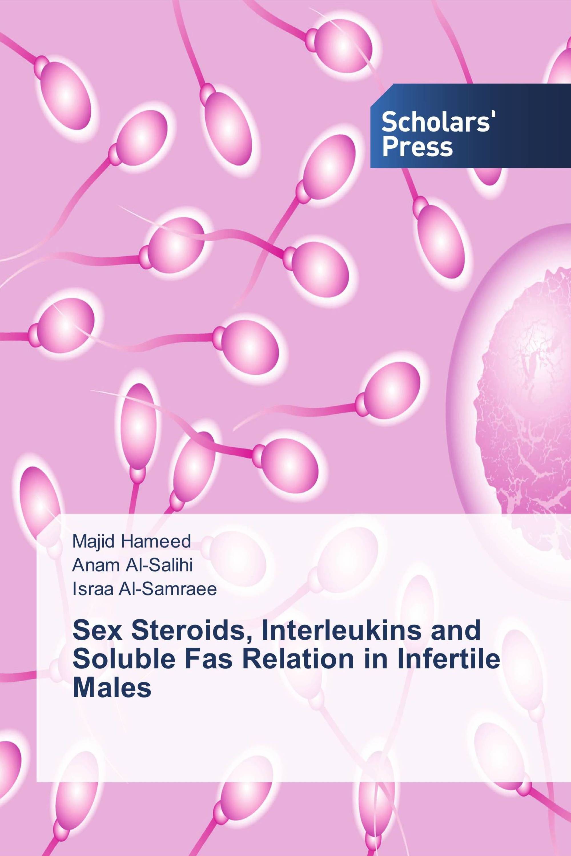 Sex Steroids, Interleukins and Soluble Fas Relation in Infertile Males