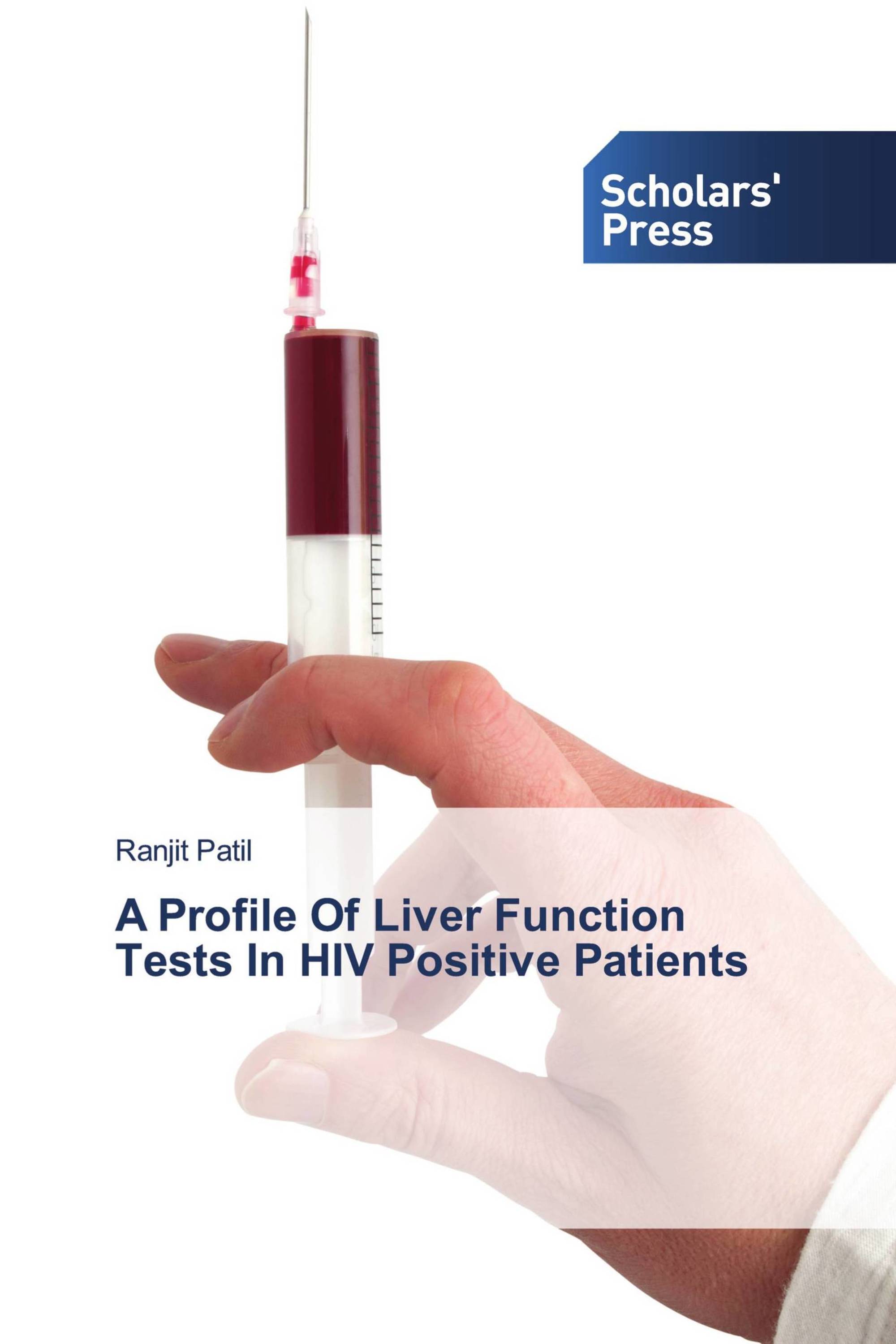 A Profile Of Liver Function Tests In HIV Positive Patients