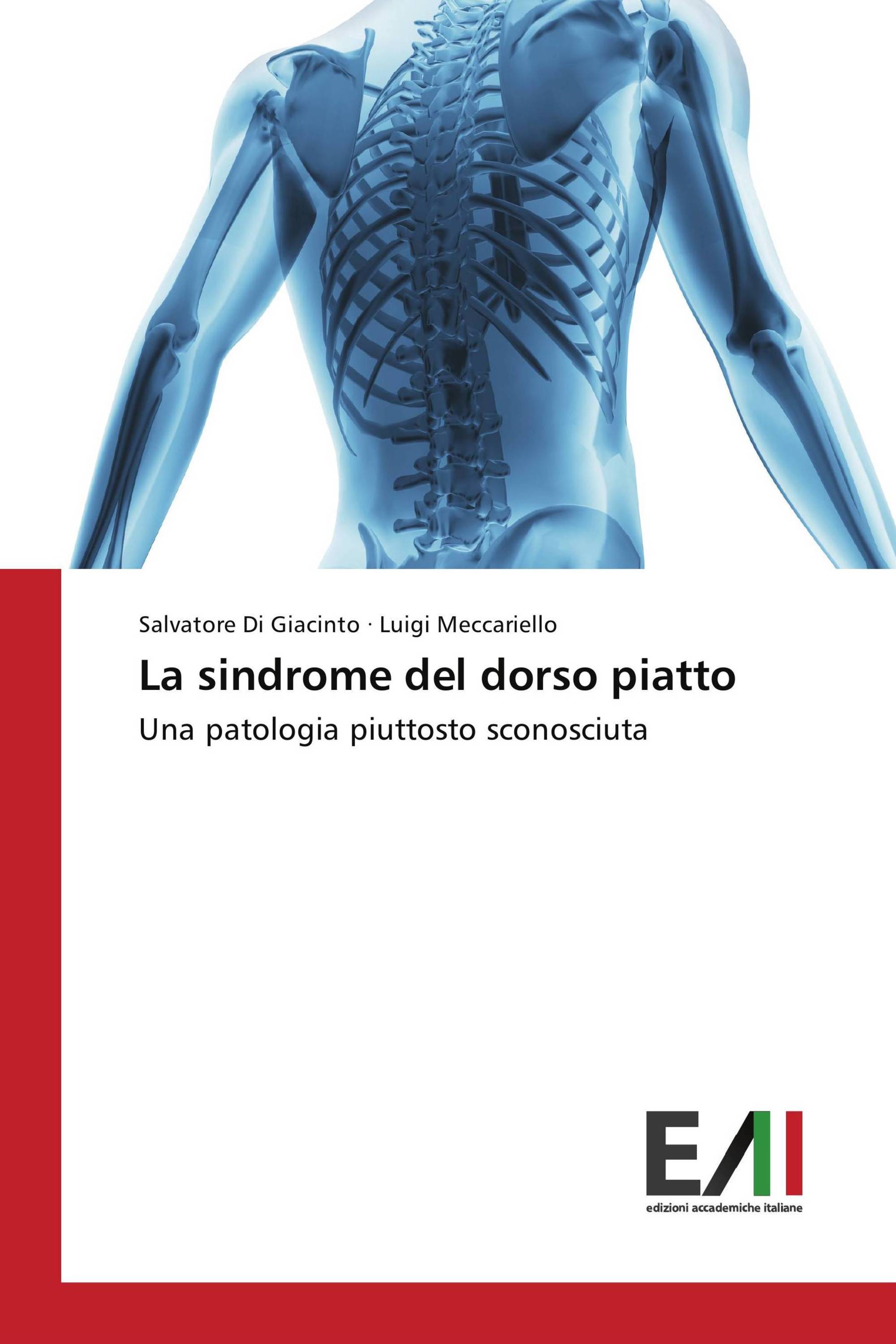 La sindrome del dorso piatto