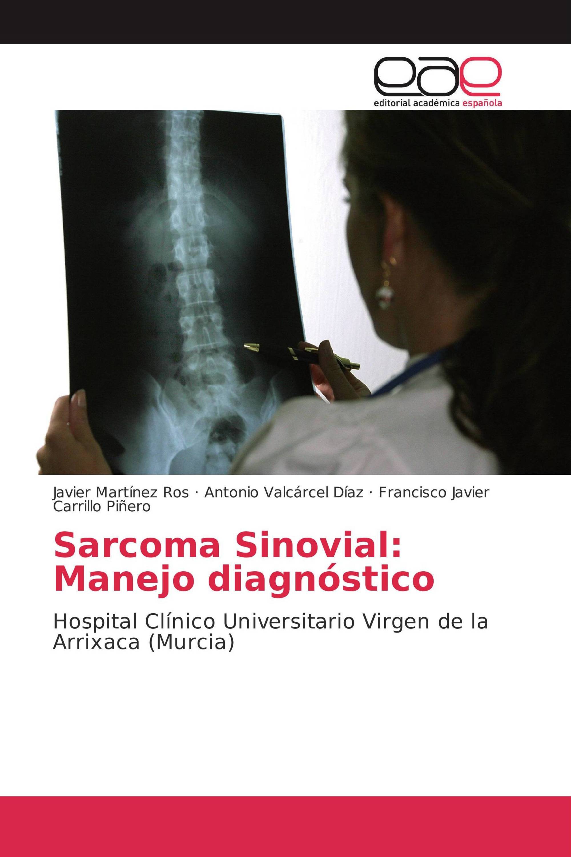 Sarcoma Sinovial: Manejo diagnóstico