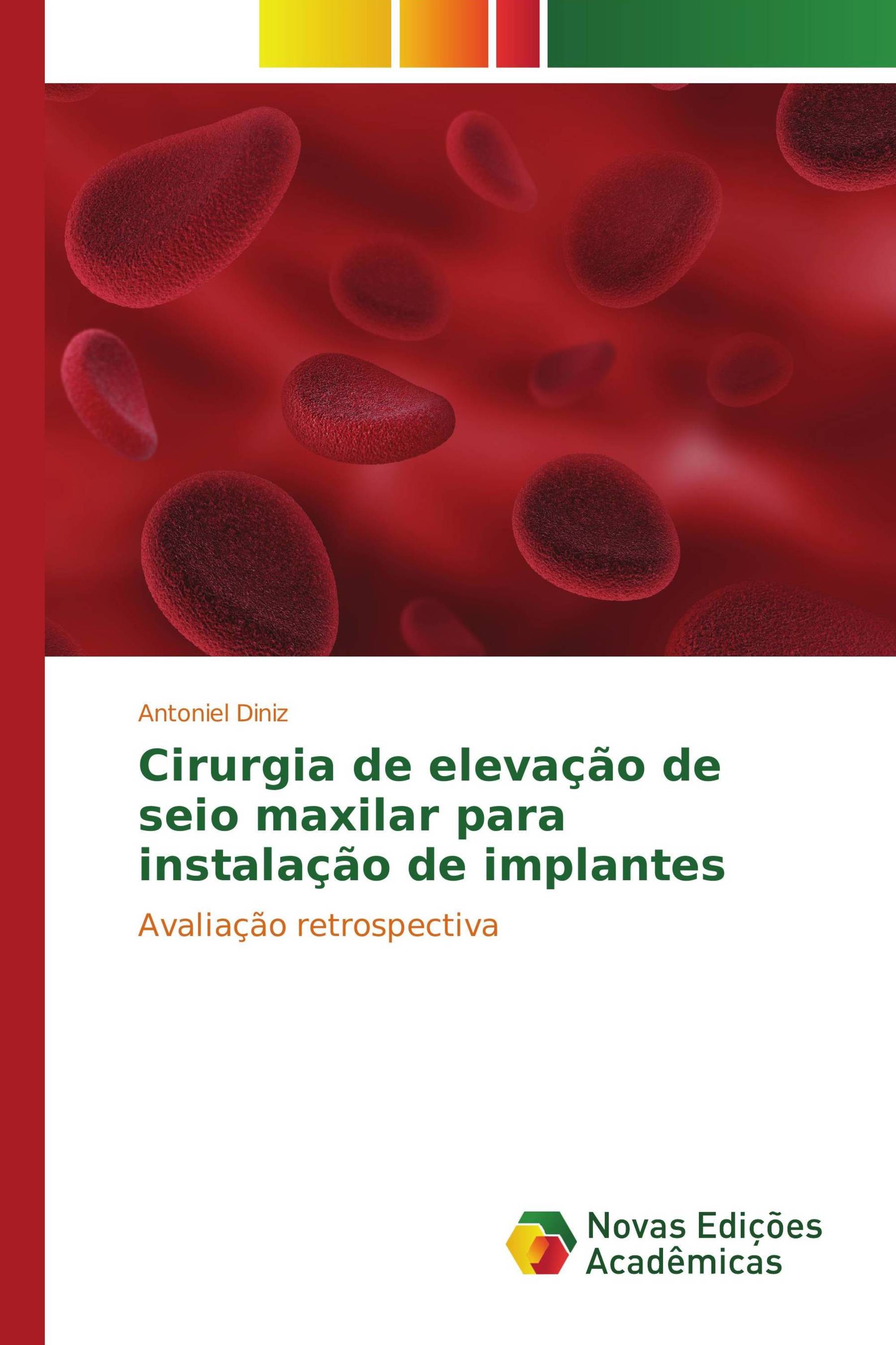 Cirurgia de elevação de seio maxilar para instalação de implantes