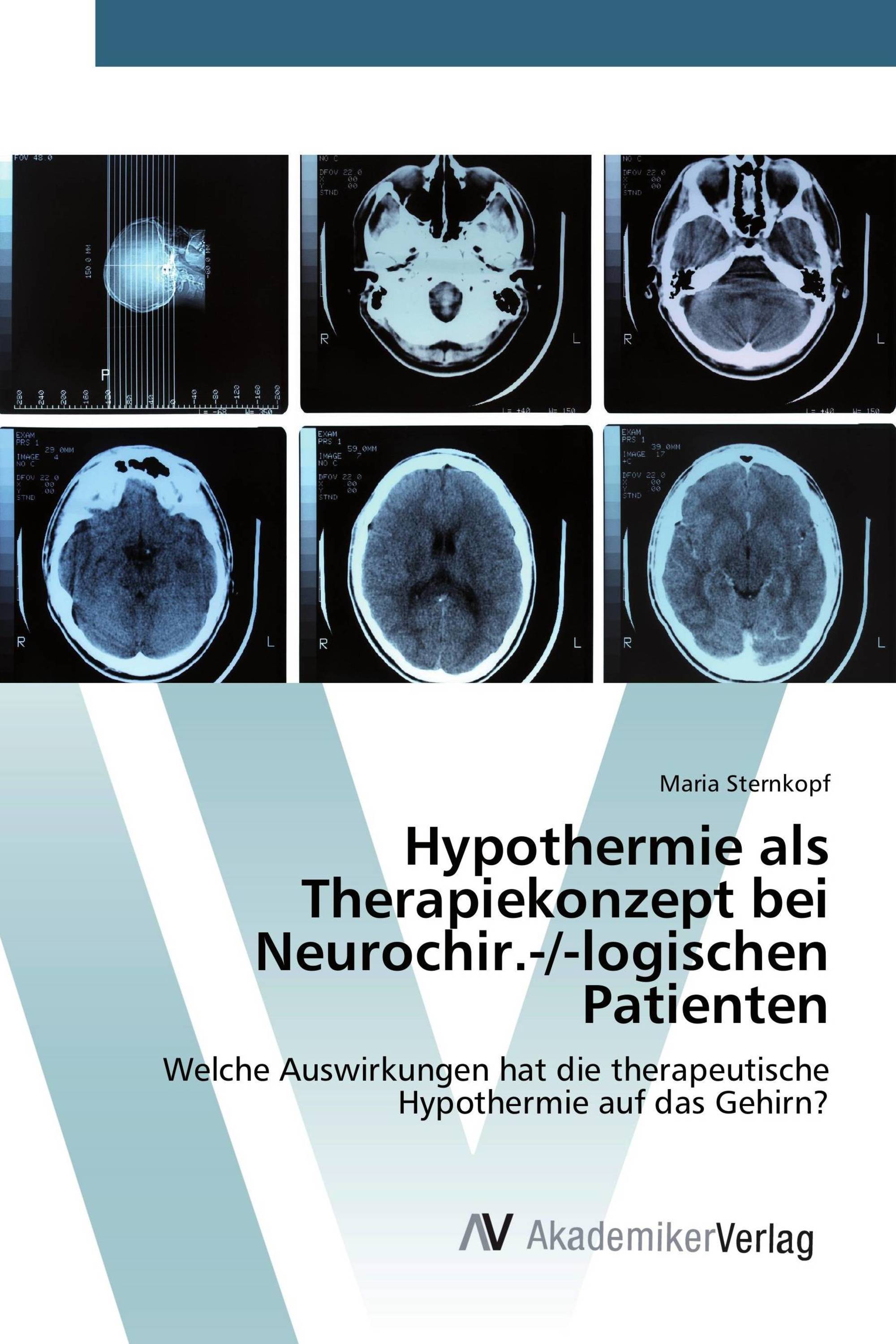 Hypothermie als Therapiekonzept bei Neurochir.-/-logischen Patienten