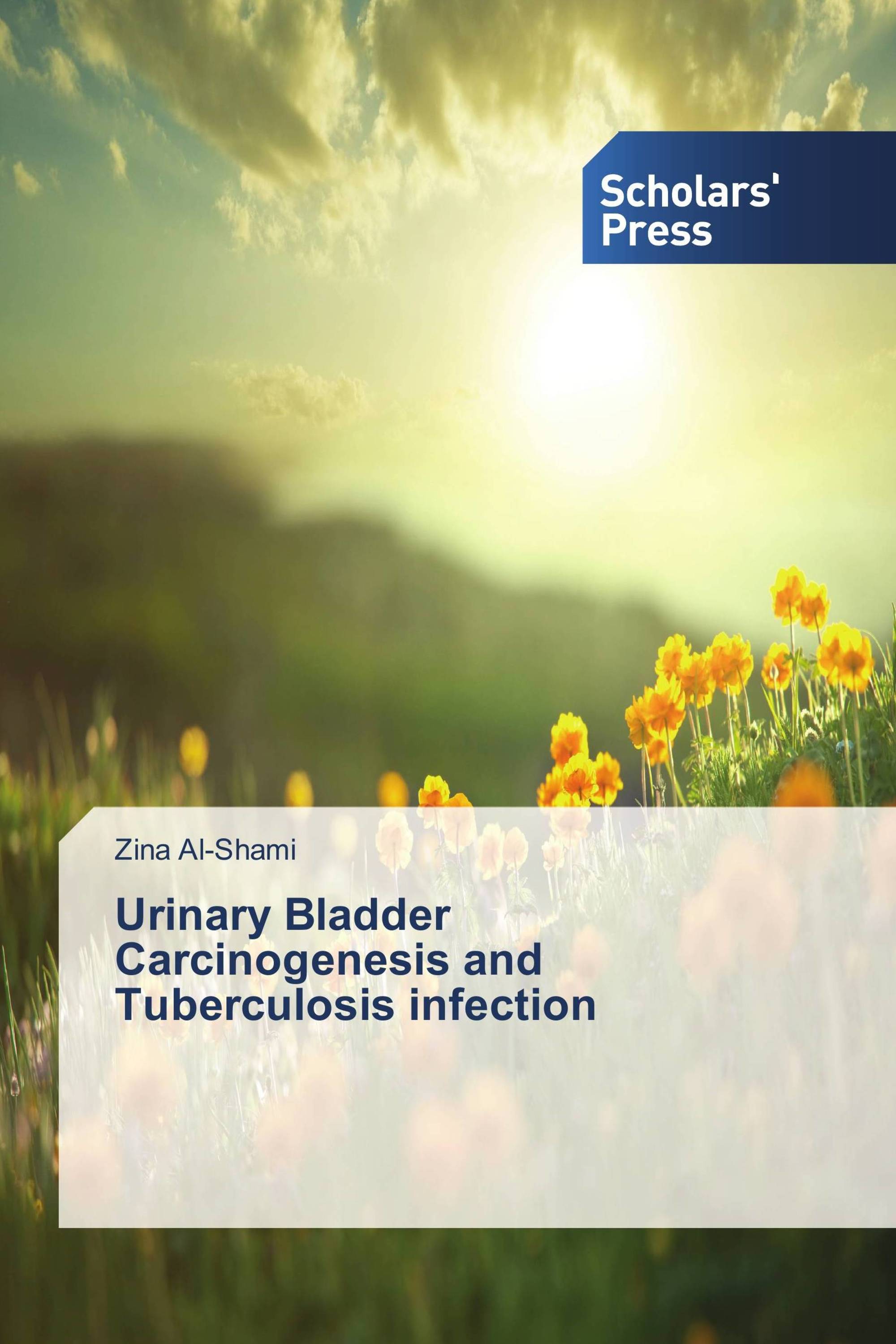 Urinary Bladder Carcinogenesis and Tuberculosis infection