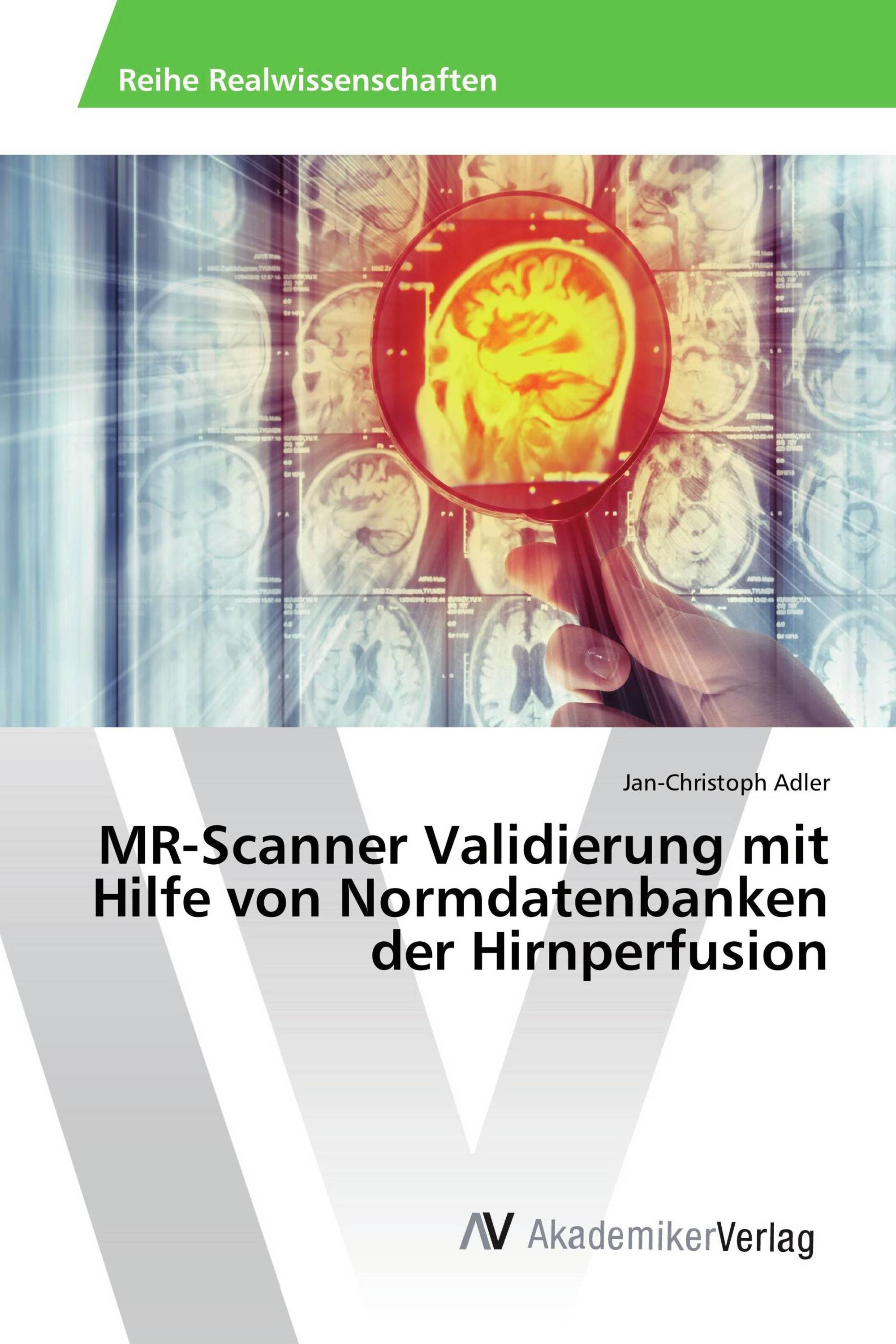 MR-Scanner Validierung mit Hilfe von Normdatenbanken der Hirnperfusion