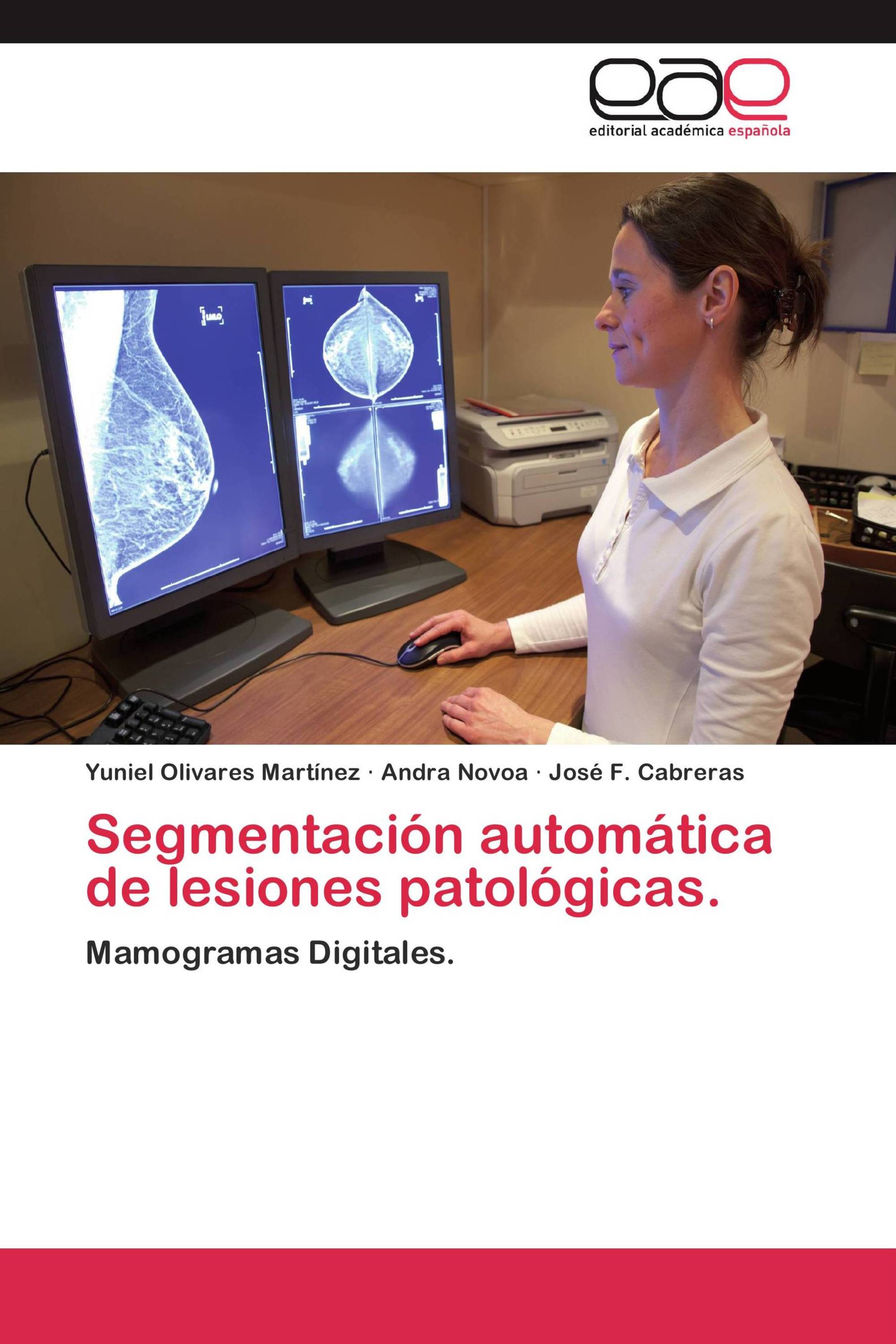 Segmentación automática de lesiones patológicas.