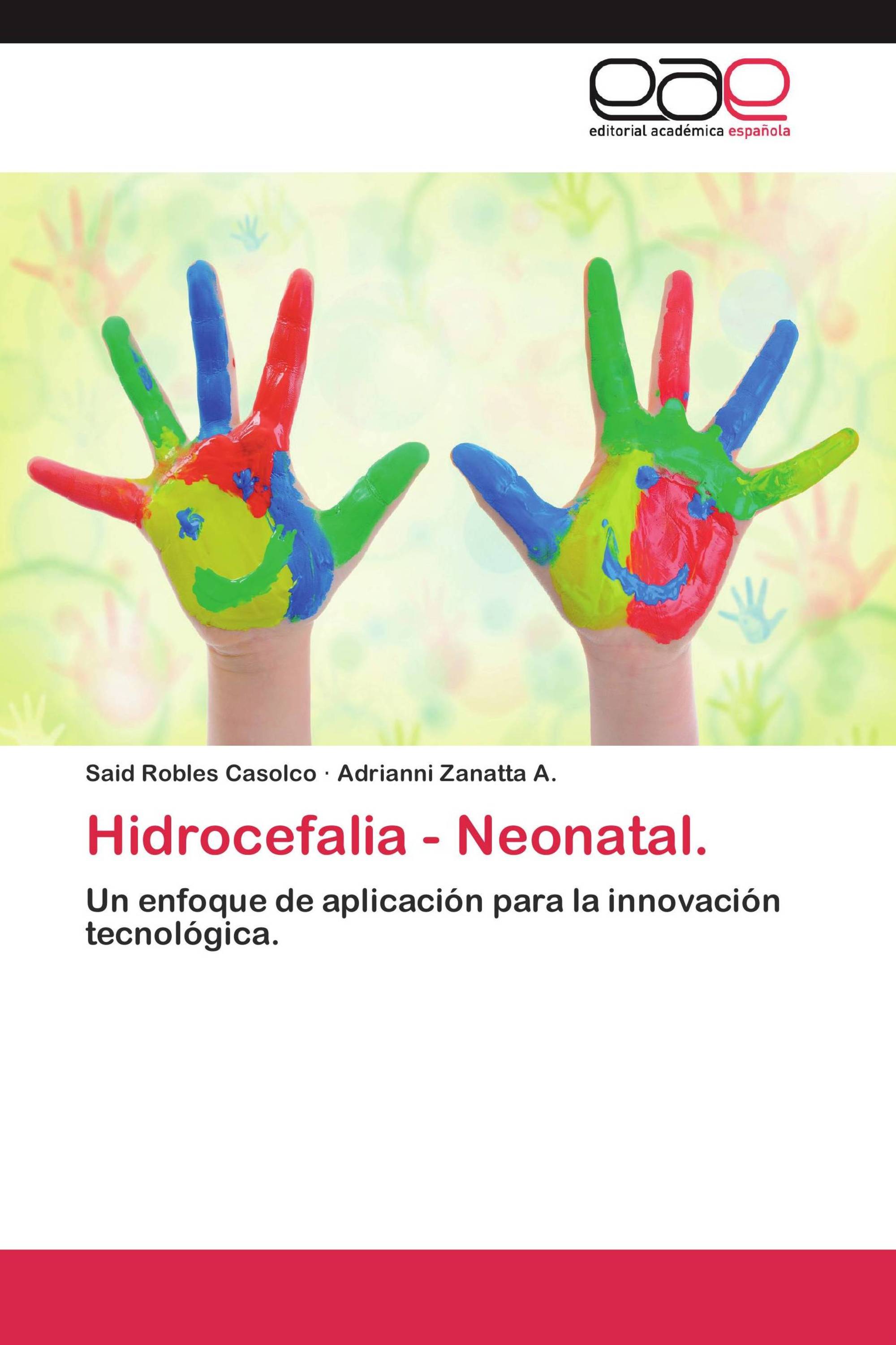 Hidrocefalia - Neonatal.