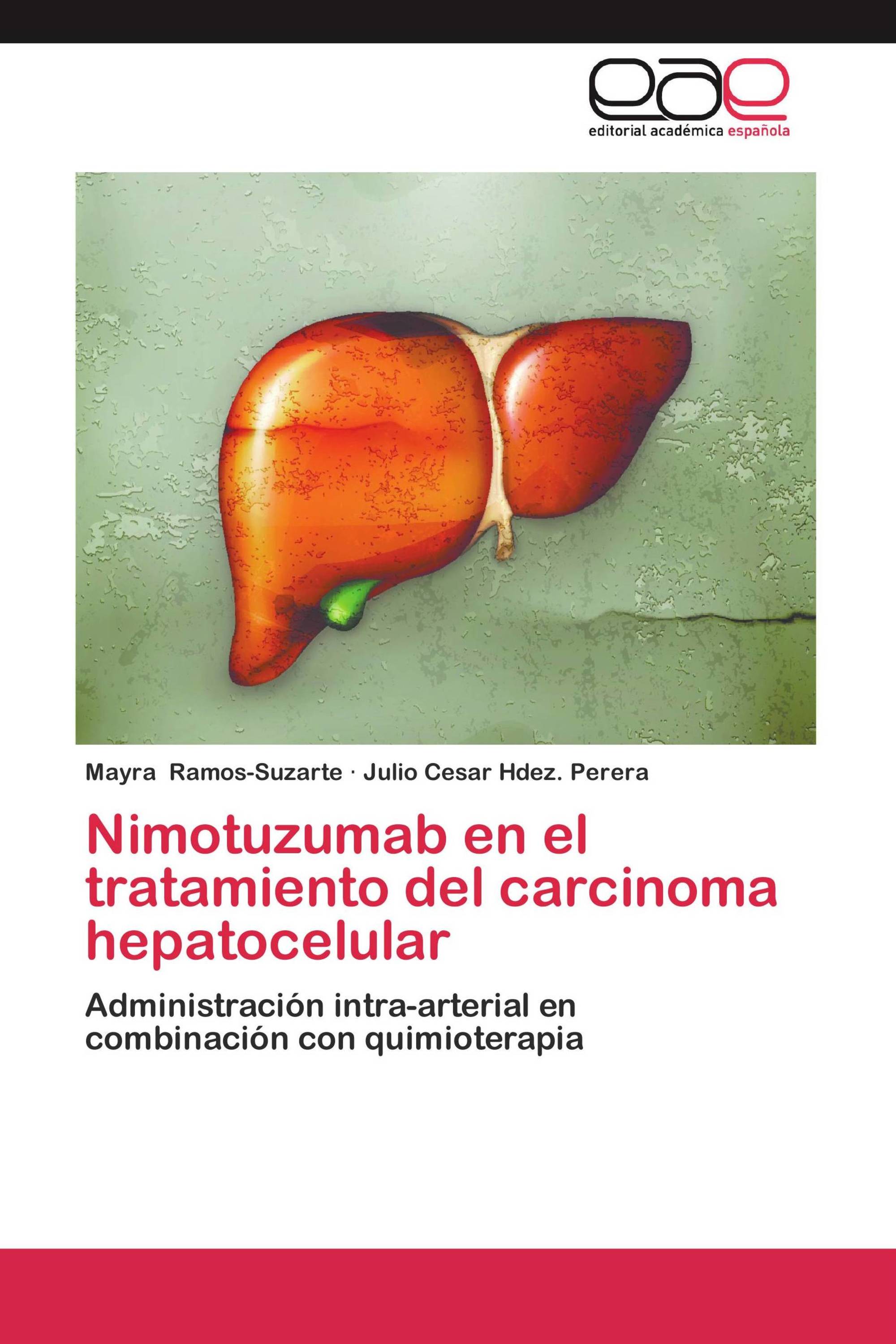 Nimotuzumab en el tratamiento del carcinoma hepatocelular