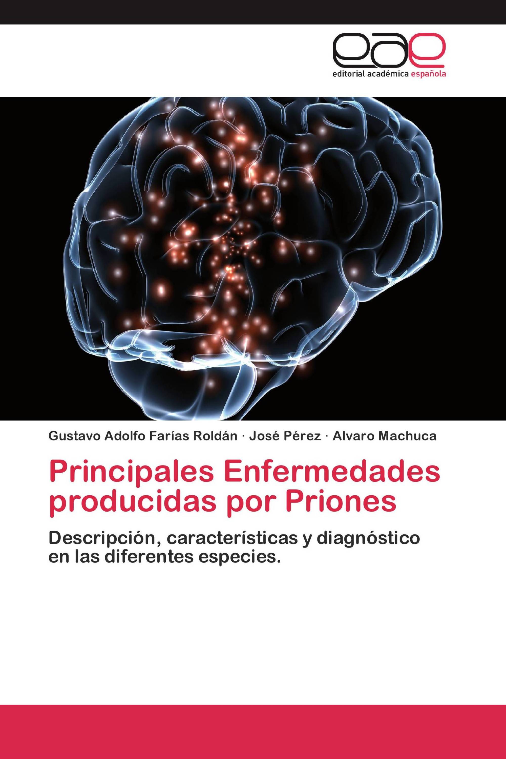 Principales Enfermedades producidas por Priones