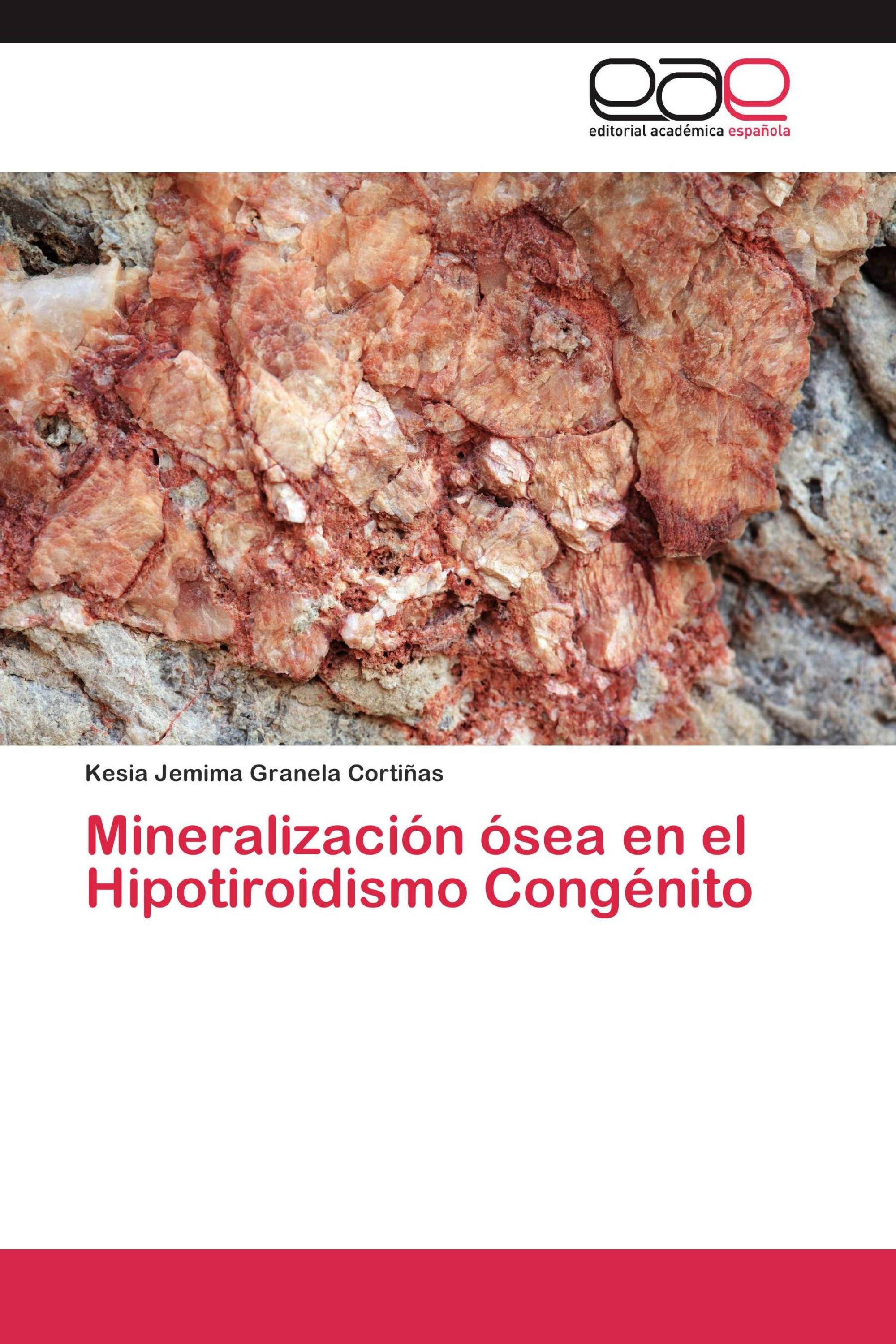 Mineralización ósea en el Hipotiroidismo Congénito