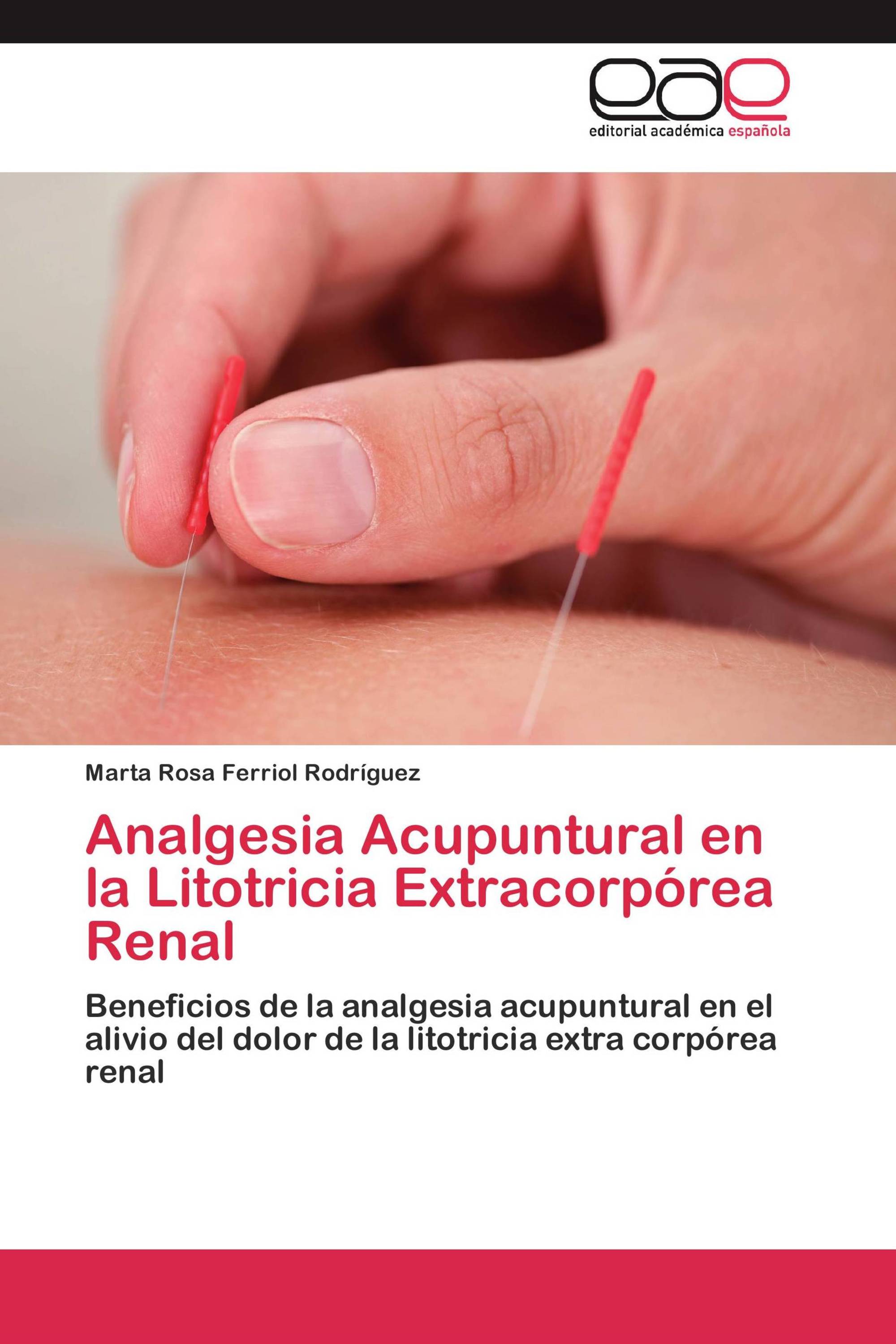 Analgesia Acupuntural en la Litotricia Extracorpórea Renal