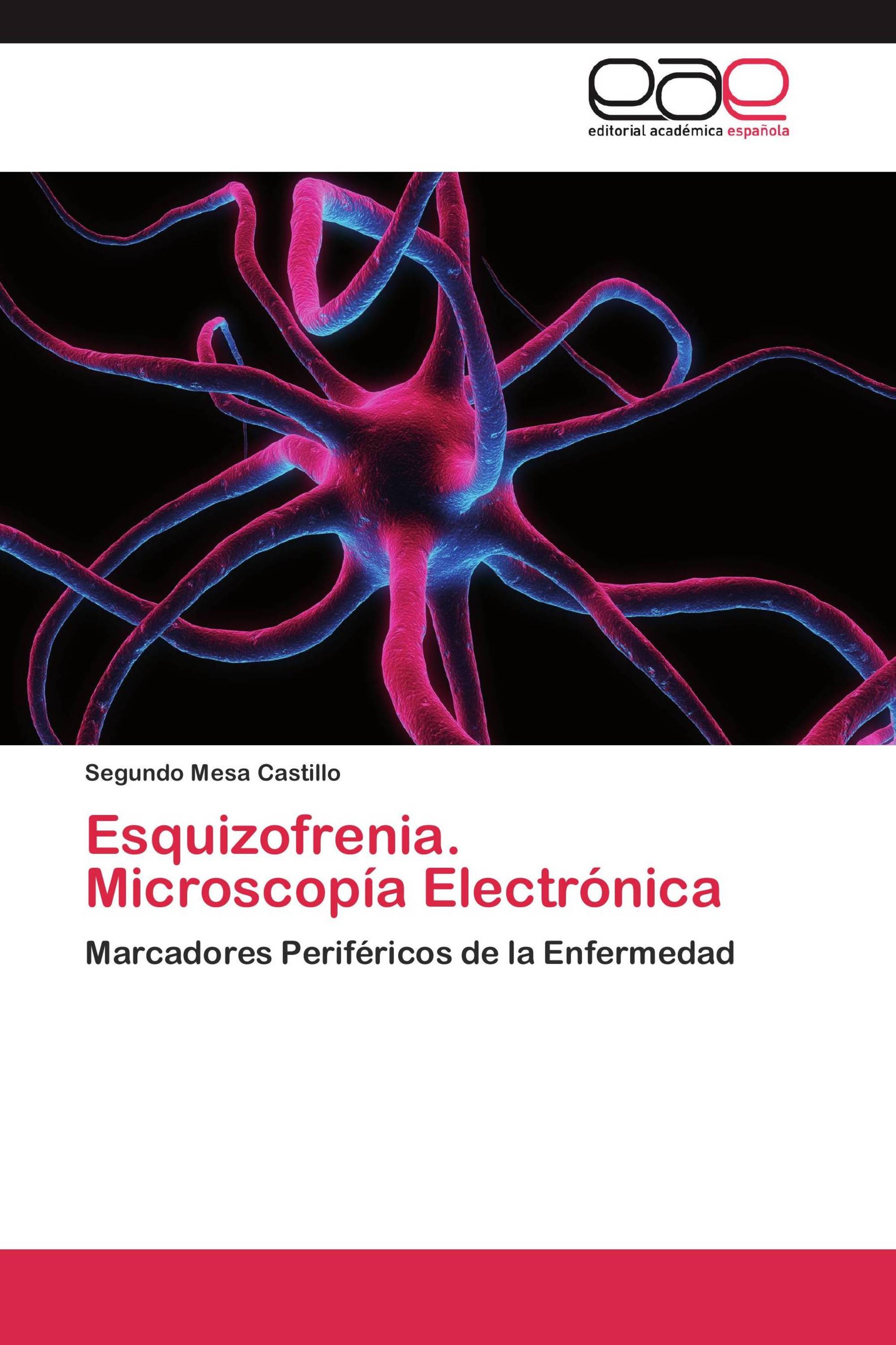 Esquizofrenia. Microscopía Electrónica