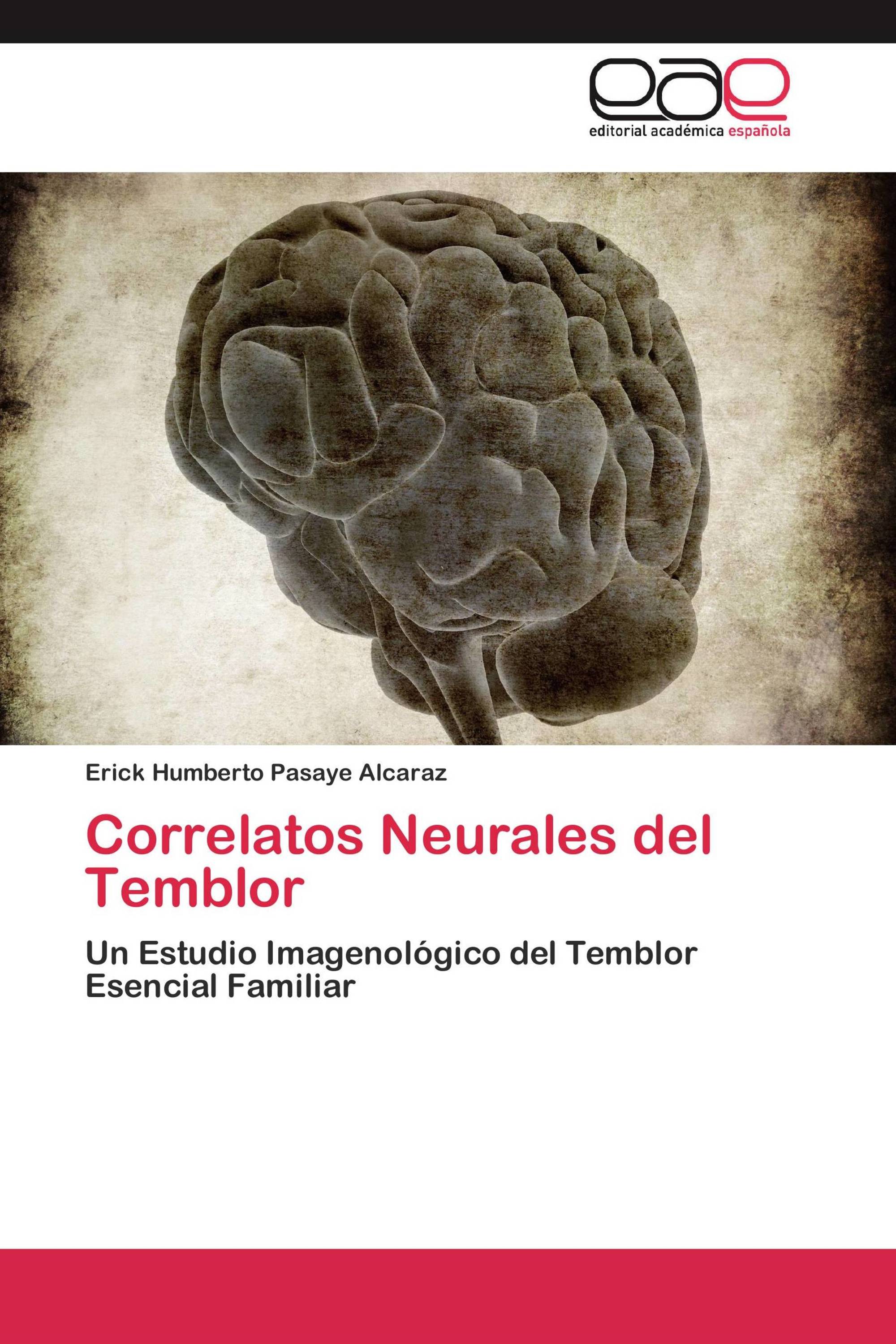Correlatos Neurales del Temblor