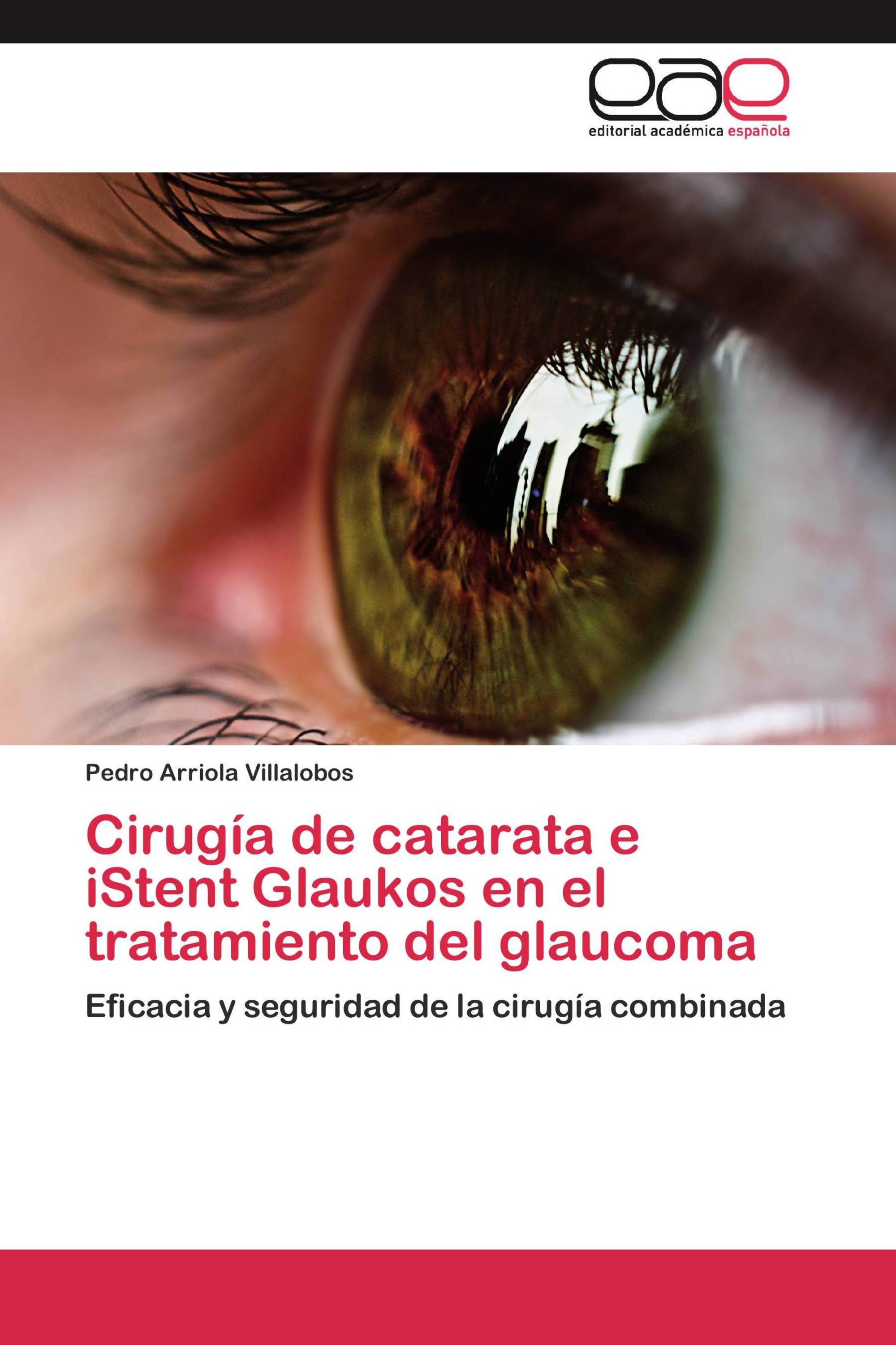 Cirugía de catarata e iStent Glaukos en el tratamiento del glaucoma