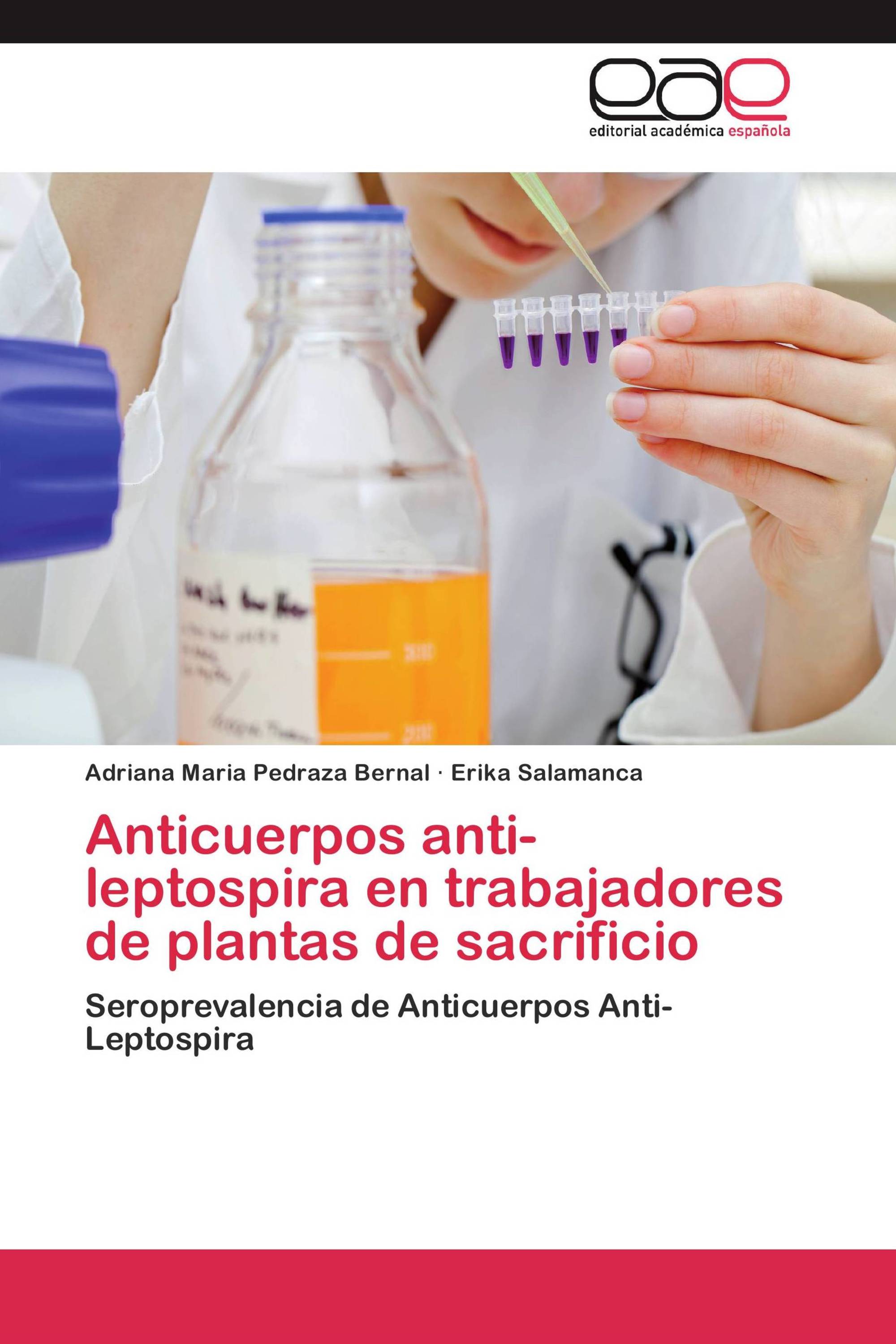 Anticuerpos anti-leptospira en trabajadores de plantas de sacrificio