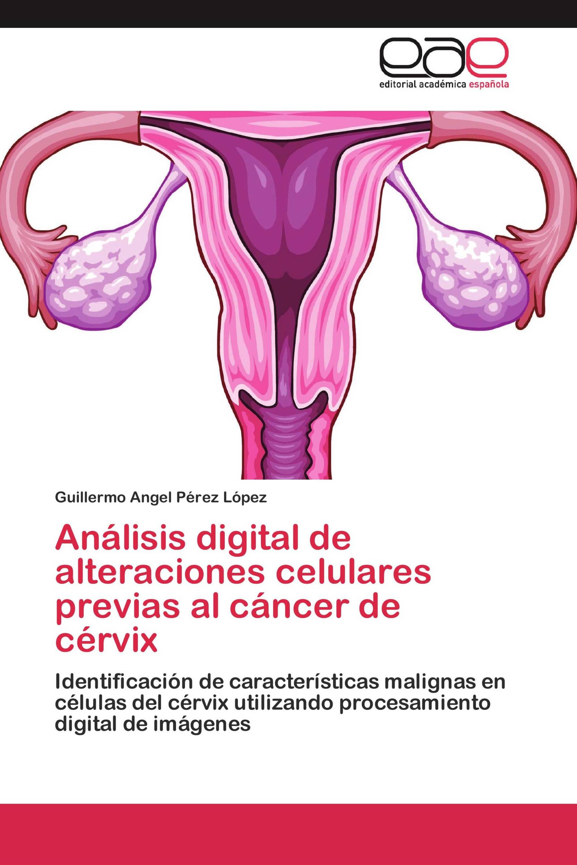 Análisis digital de alteraciones celulares previas al cáncer de cérvix