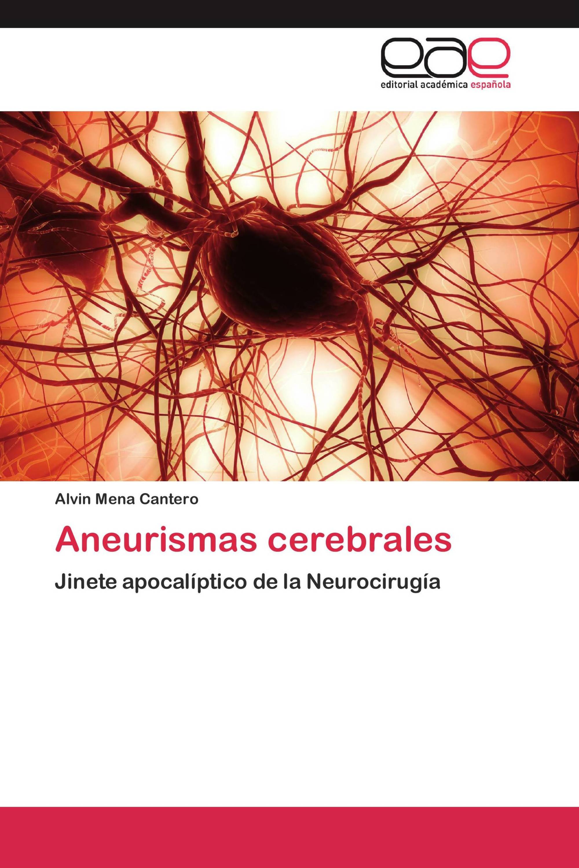 Aneurismas cerebrales