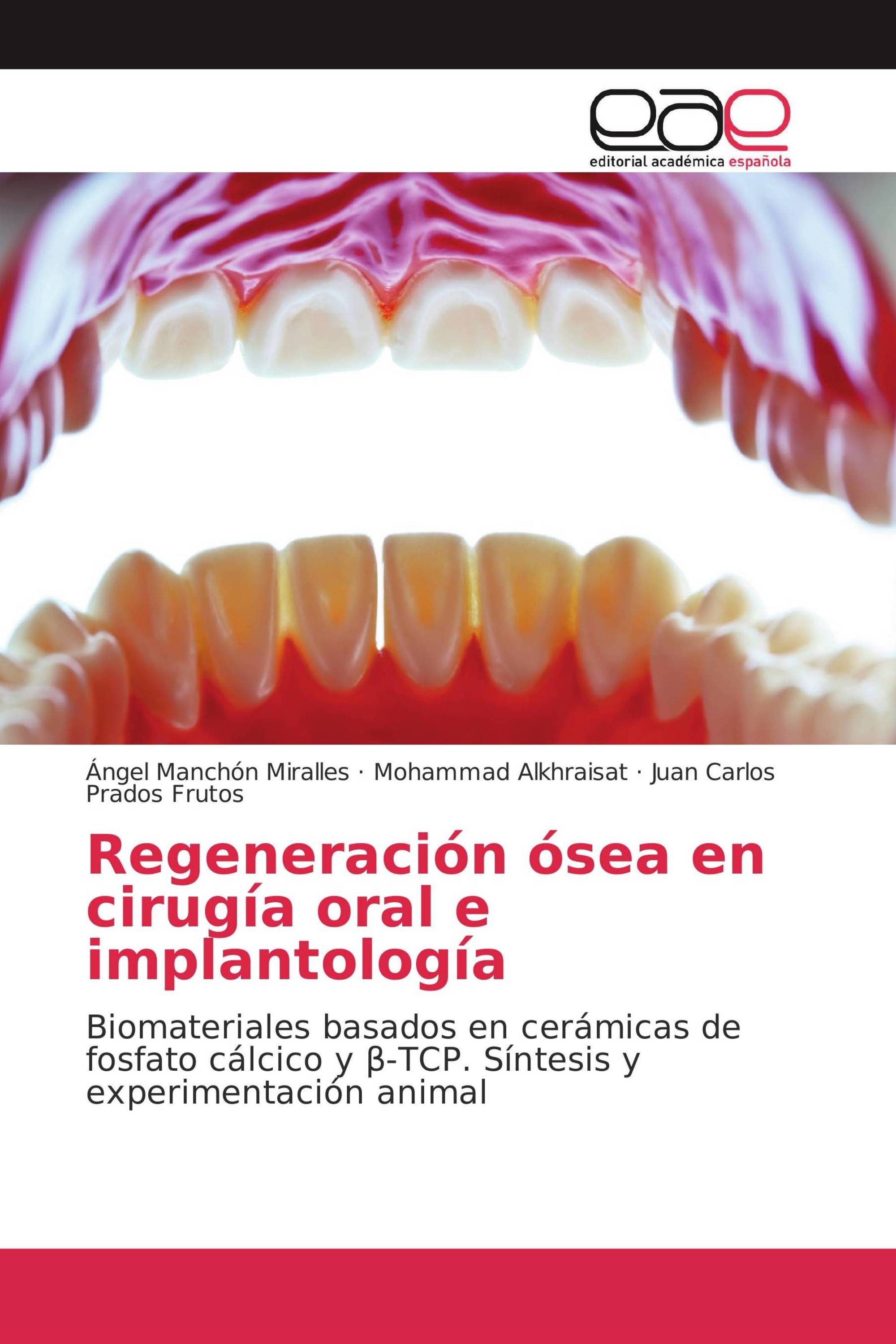 Regeneración ósea en cirugía oral e implantología