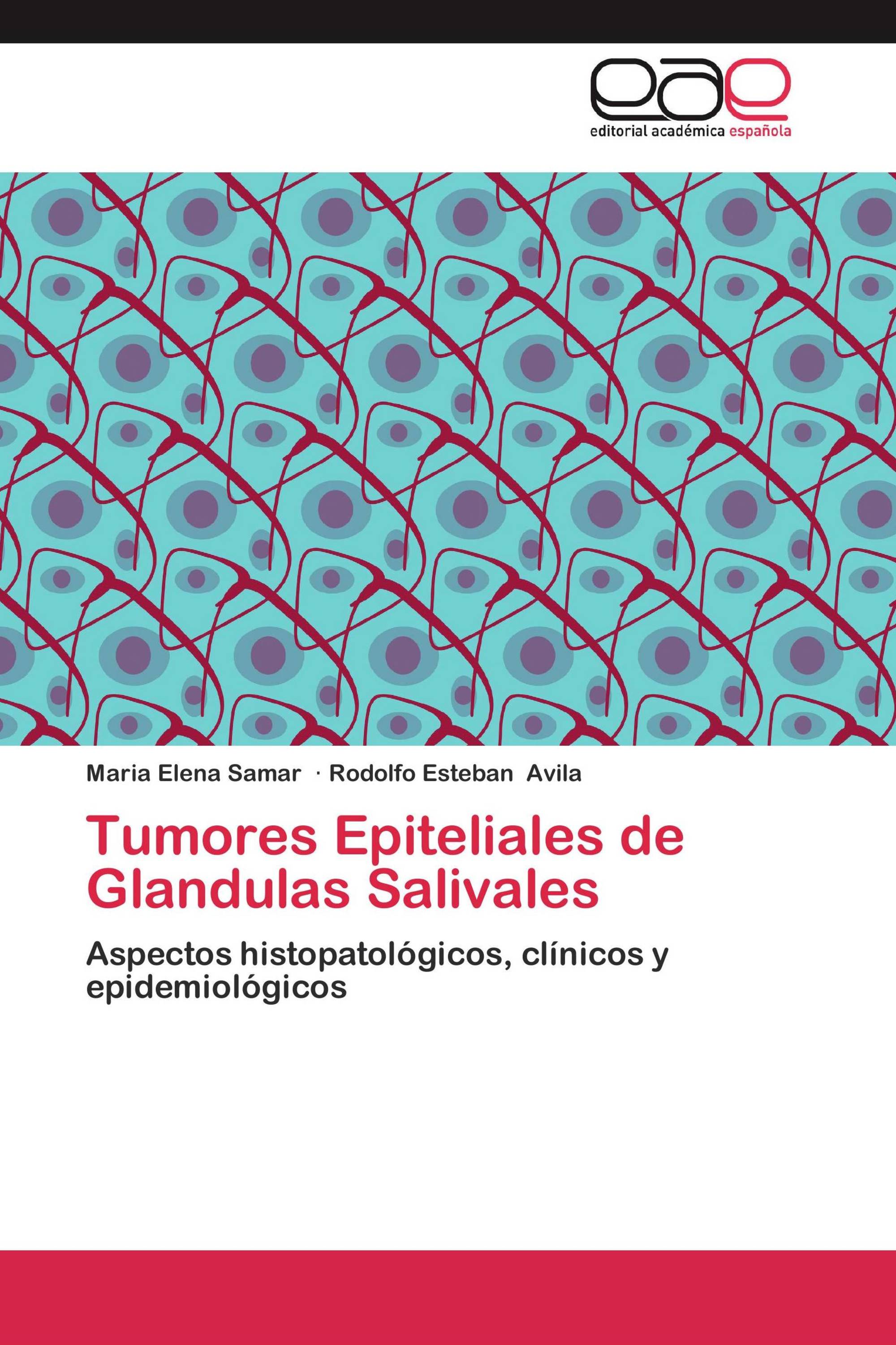 Tumores Epiteliales de Glandulas Salivales