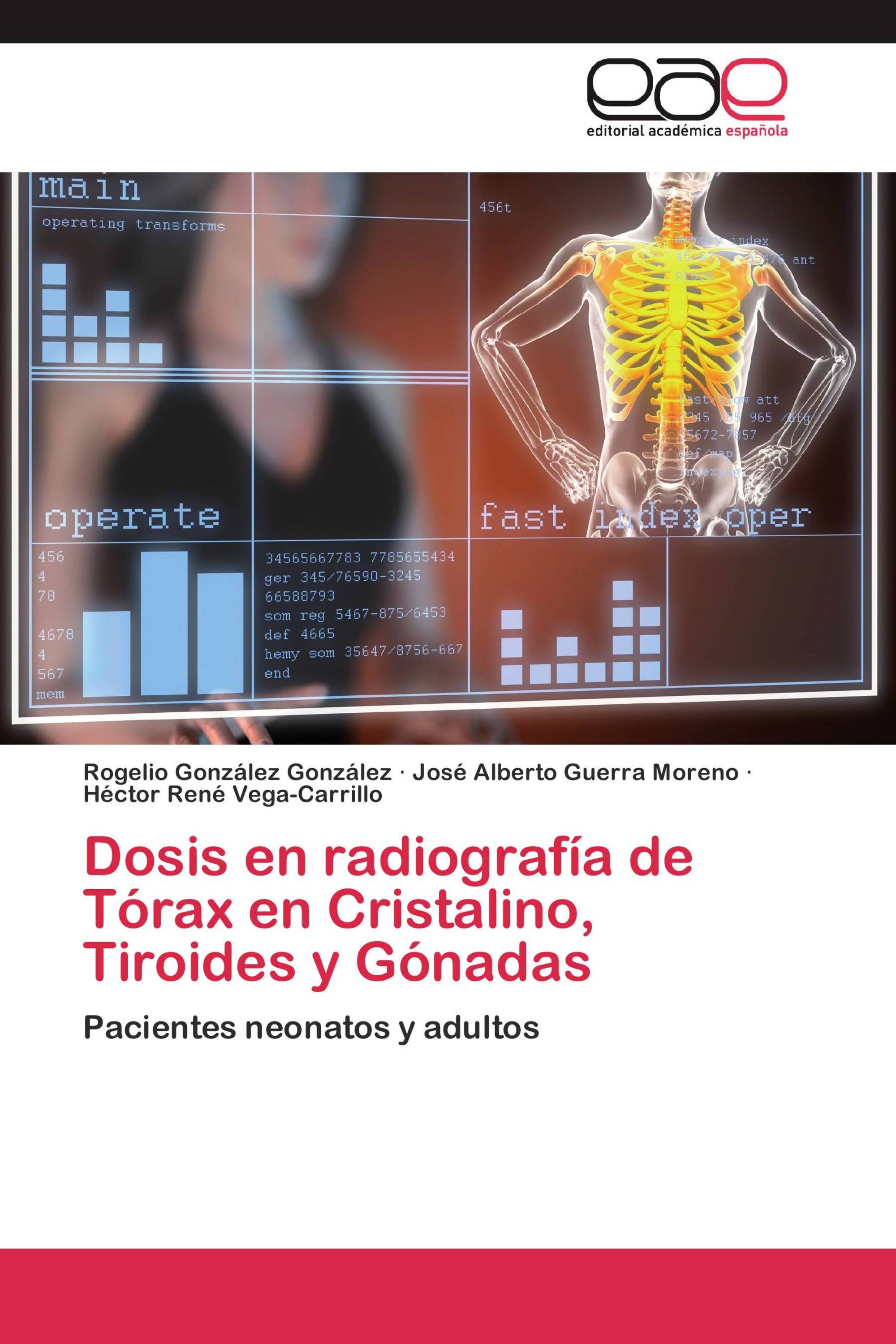 Dosis en radiografía de Tórax en Cristalino, Tiroides y Gónadas
