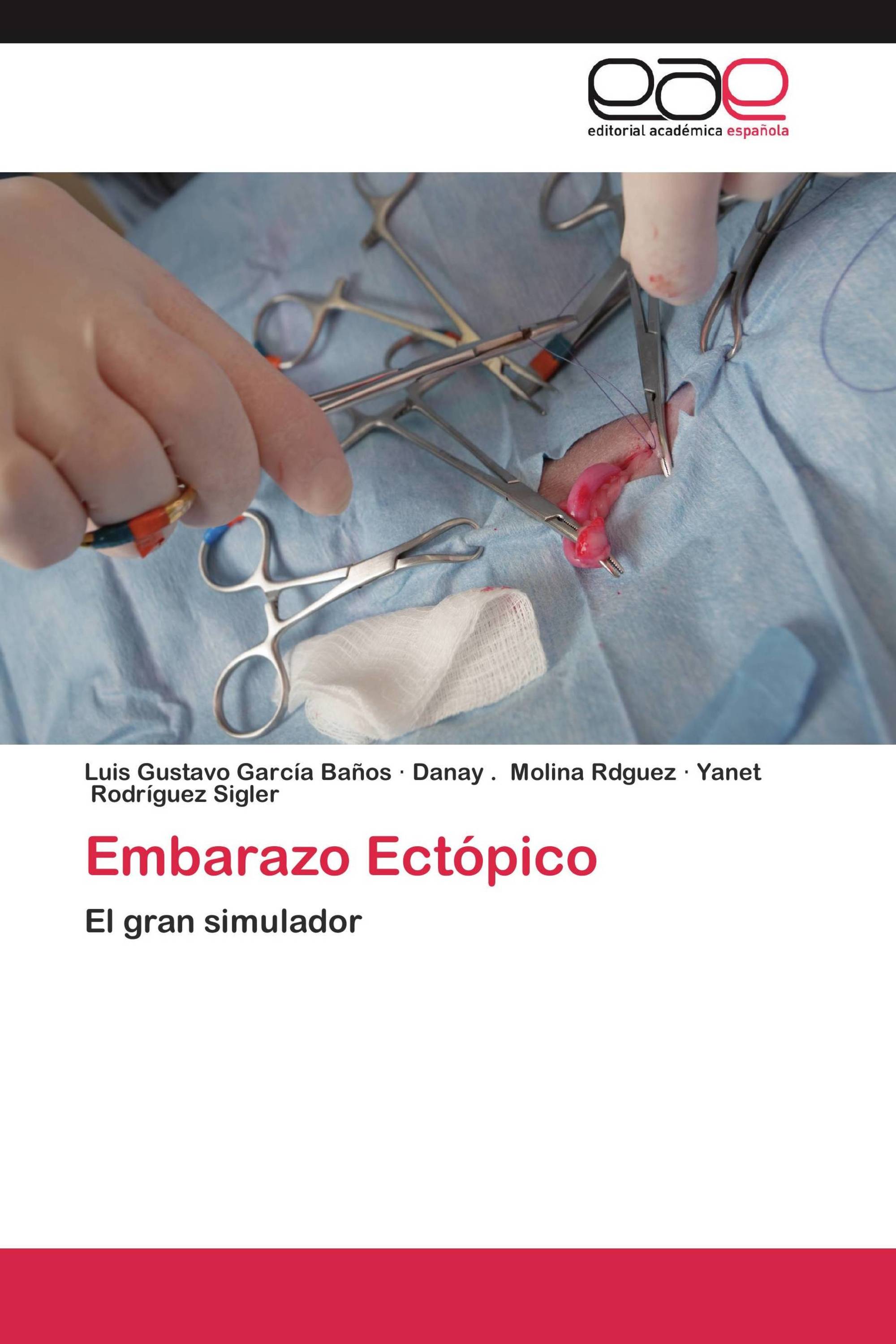 Embarazo Ectópico