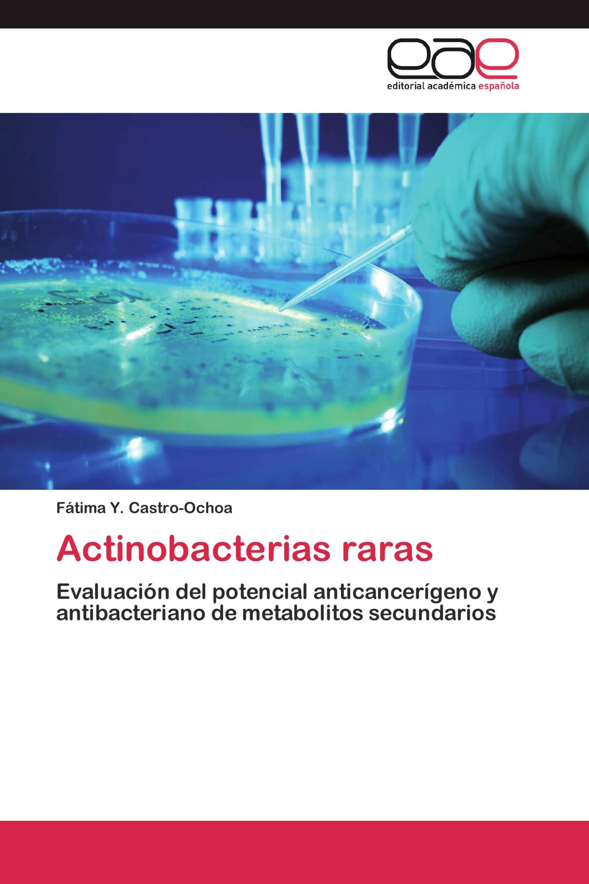 Actinobacterias raras