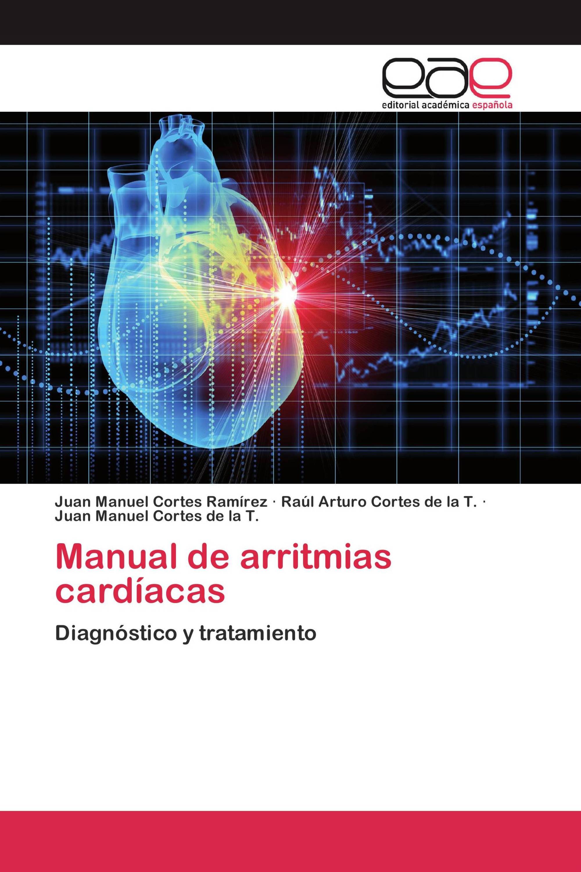 Manual de arritmias cardíacas