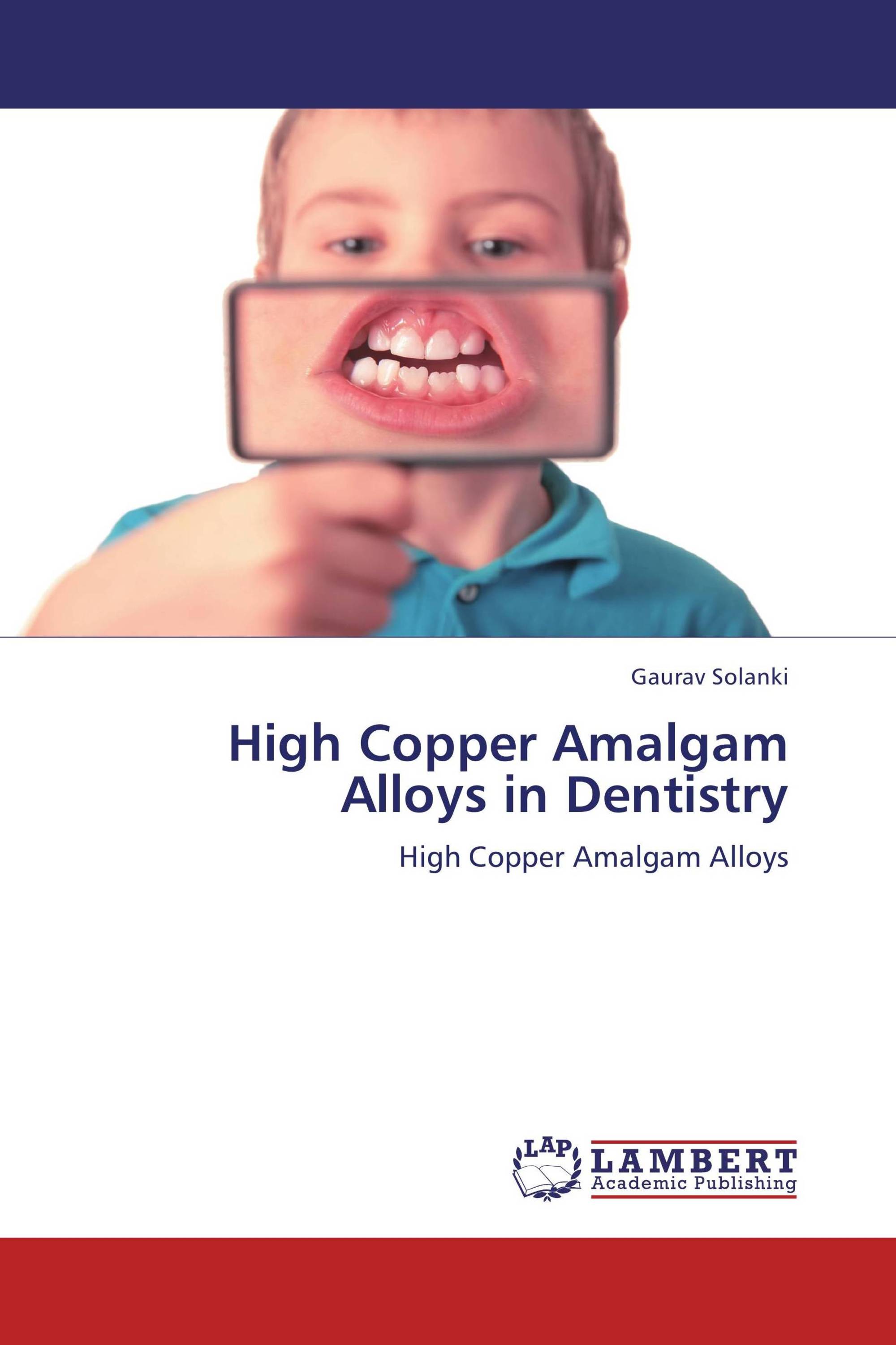 High Copper Amalgam Alloys in Dentistry / 9783659112126