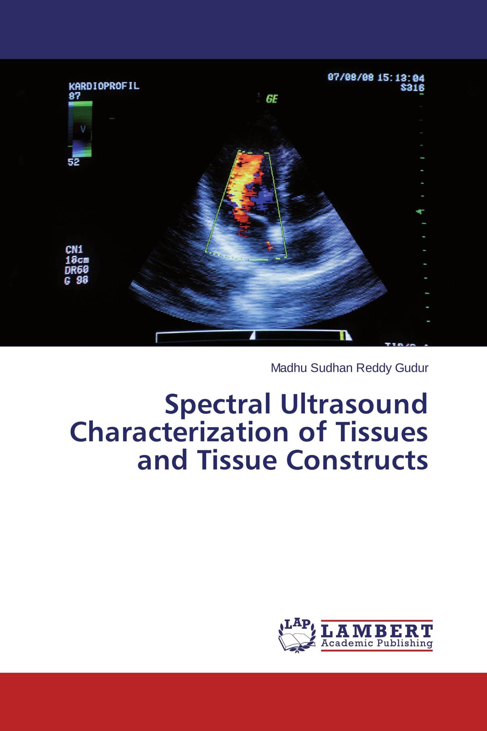 Spectral Ultrasound Characterization of Tissues and Tissue Constructs