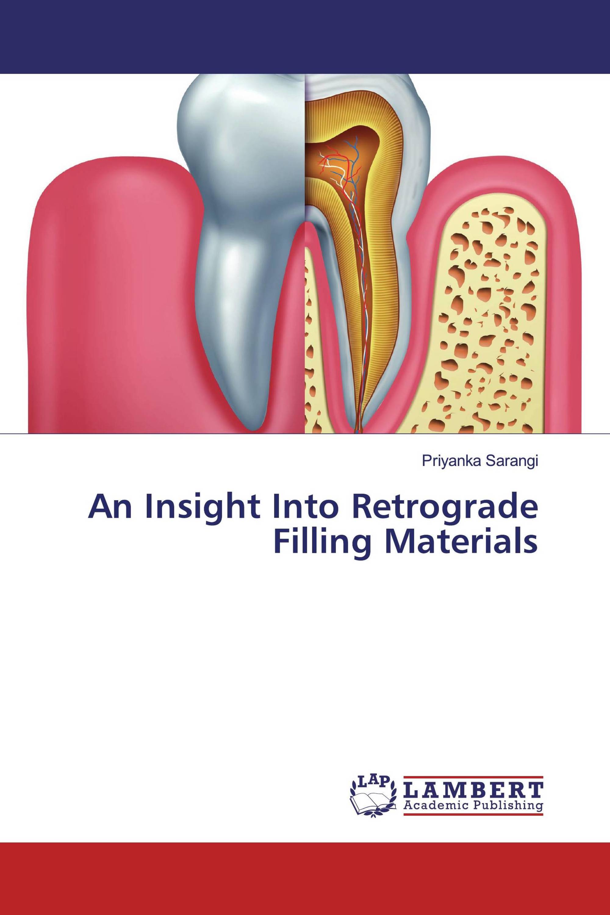 An Insight Into Retrograde Filling Materials