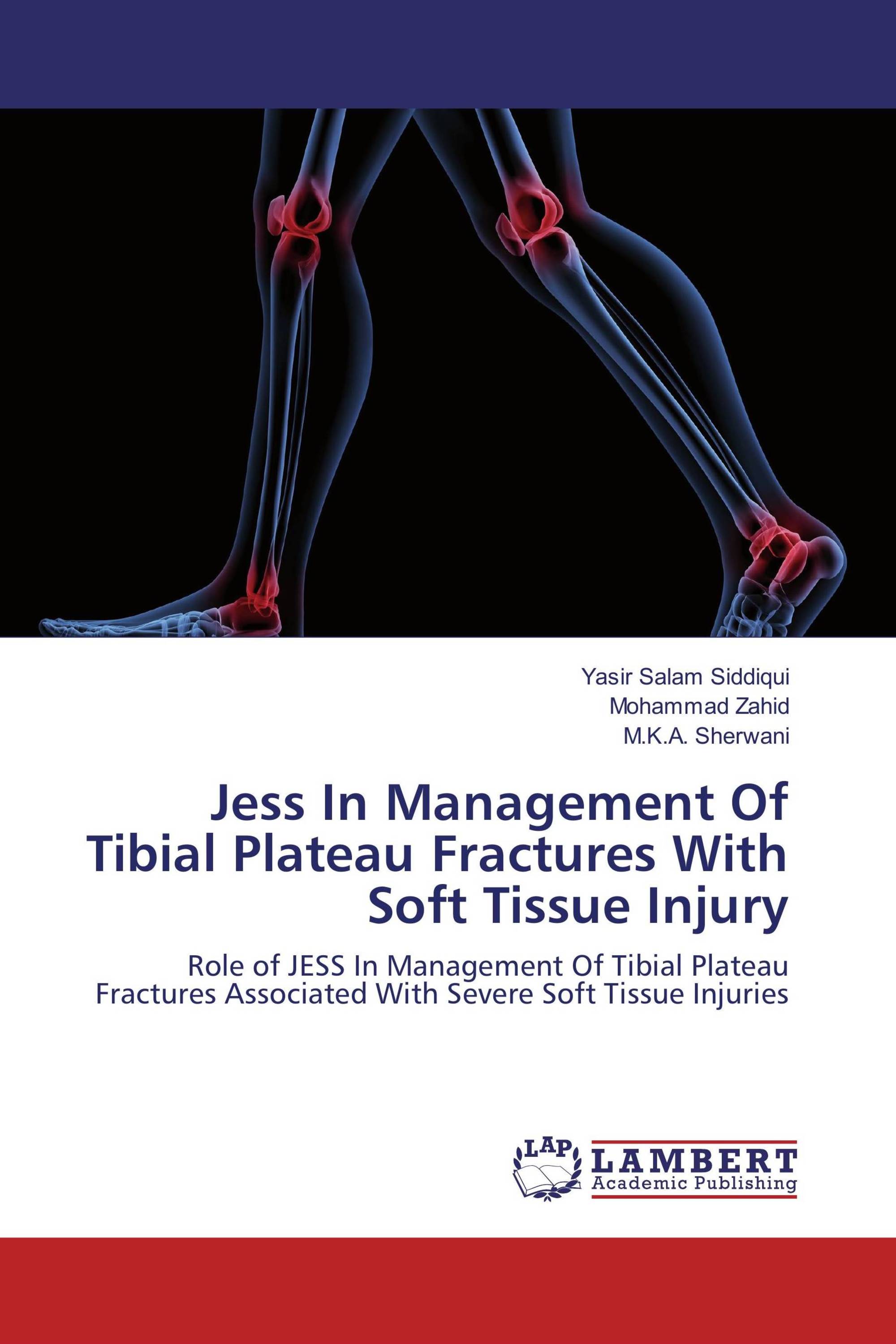 Tibial plateau thesis 05 image