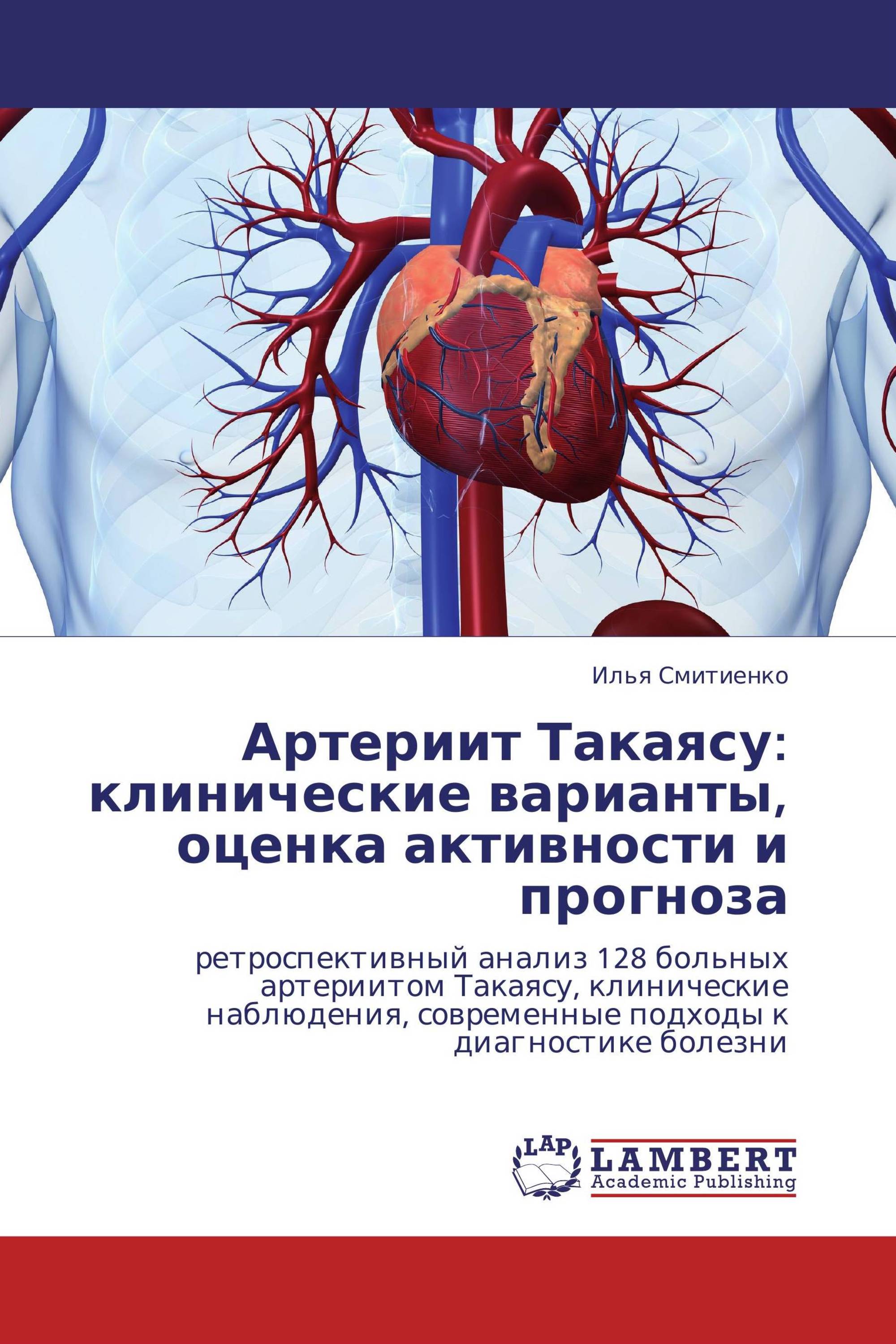 Артериит Такаясу: клинические варианты, оценка активности и прогноза