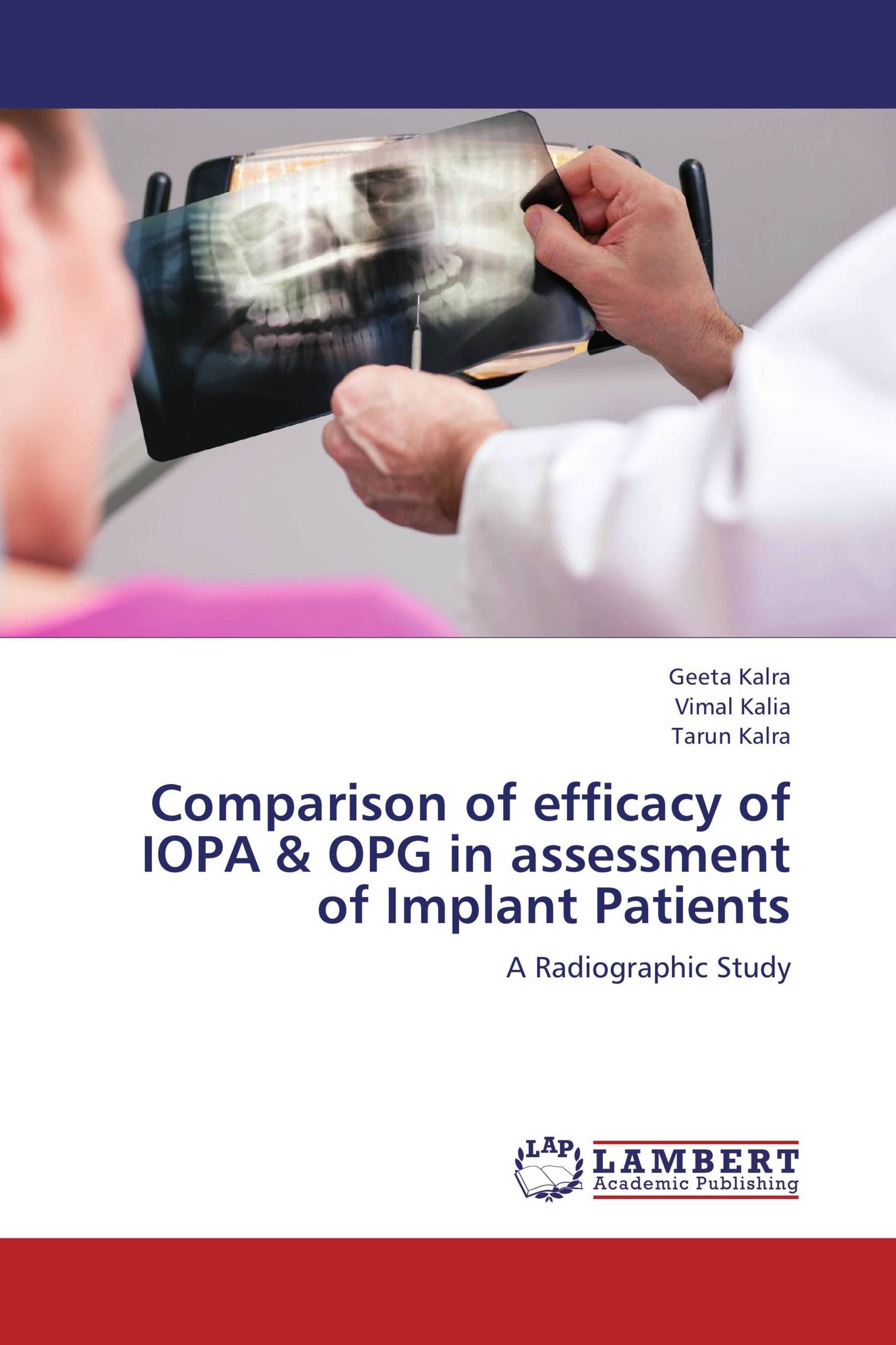 Comparison of efficacy of IOPA & OPG in assessment of Implant Patients